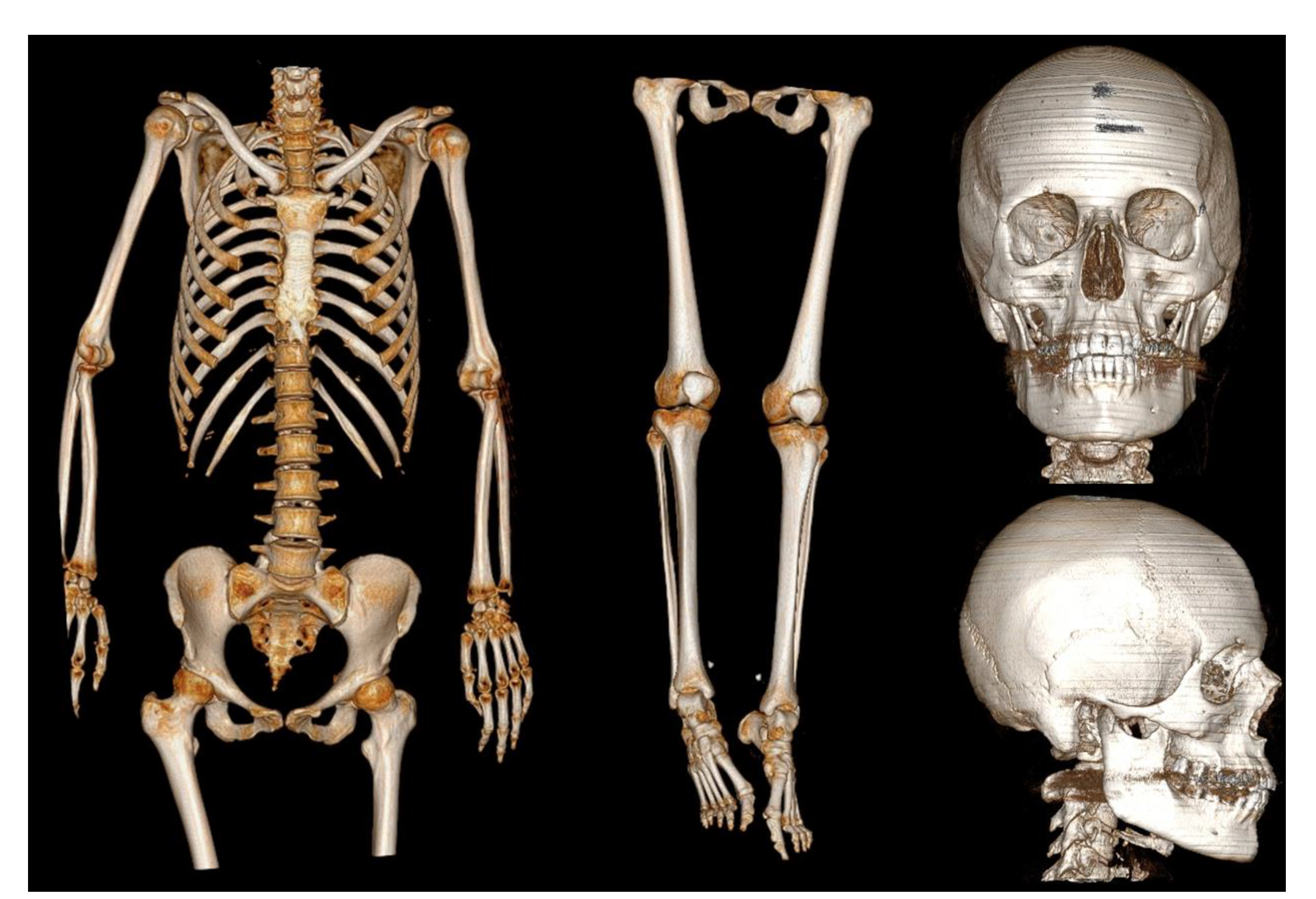 Medicina 57 00644 g003 550