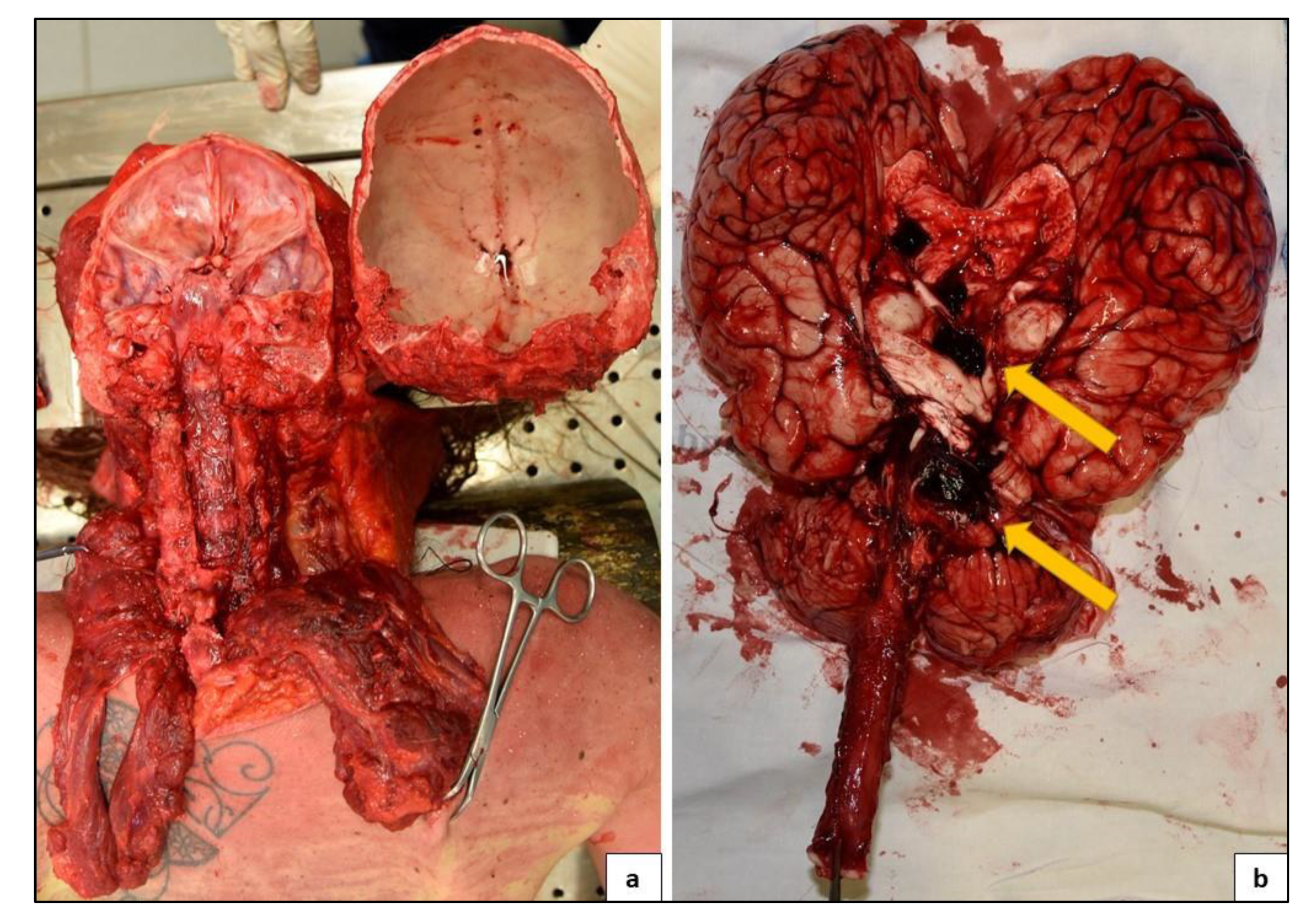 Medicina 57 00644 g004 550