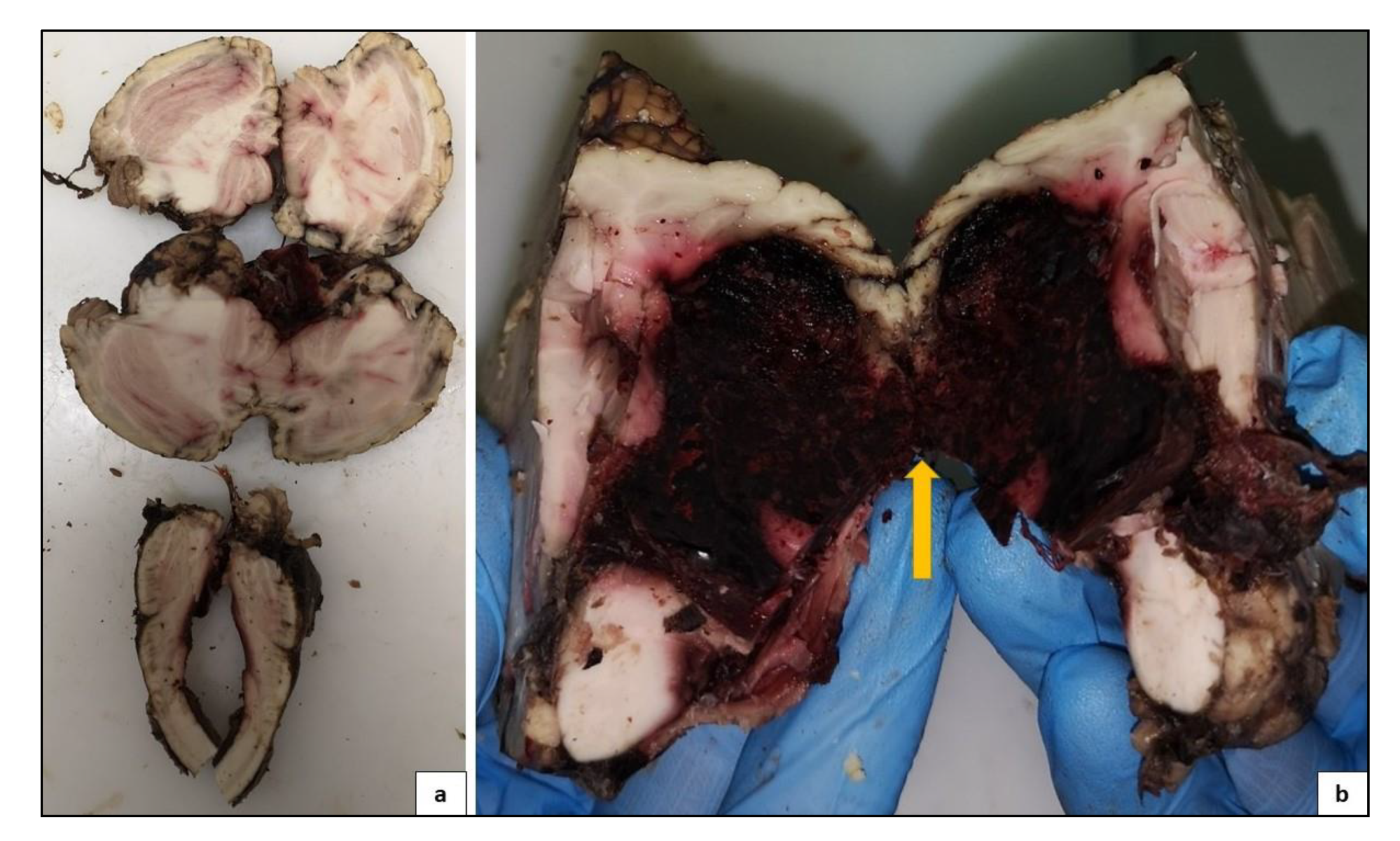 Medicina 57 00644 g005 550
