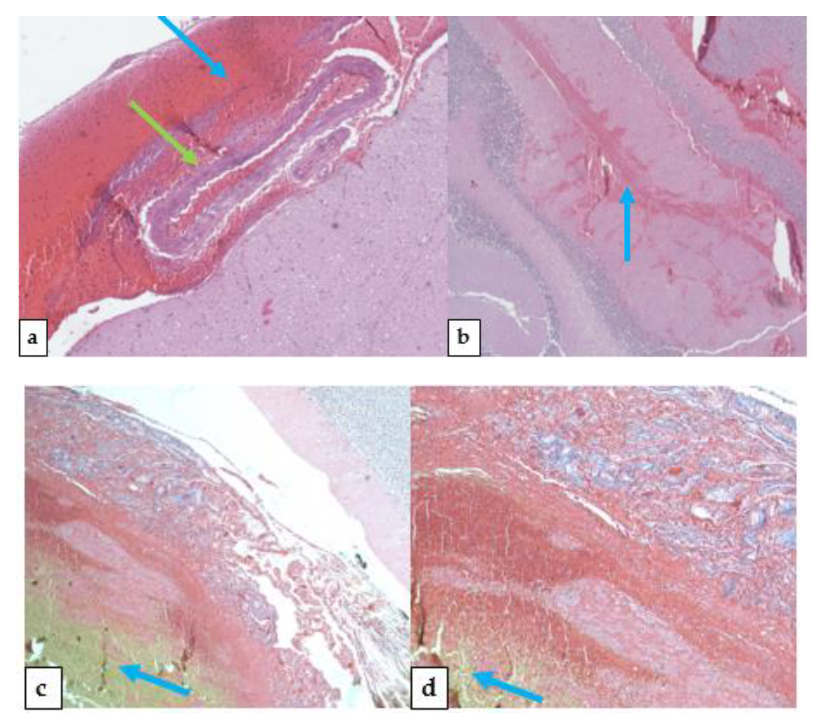 Medicina 57 00644 g006 550
