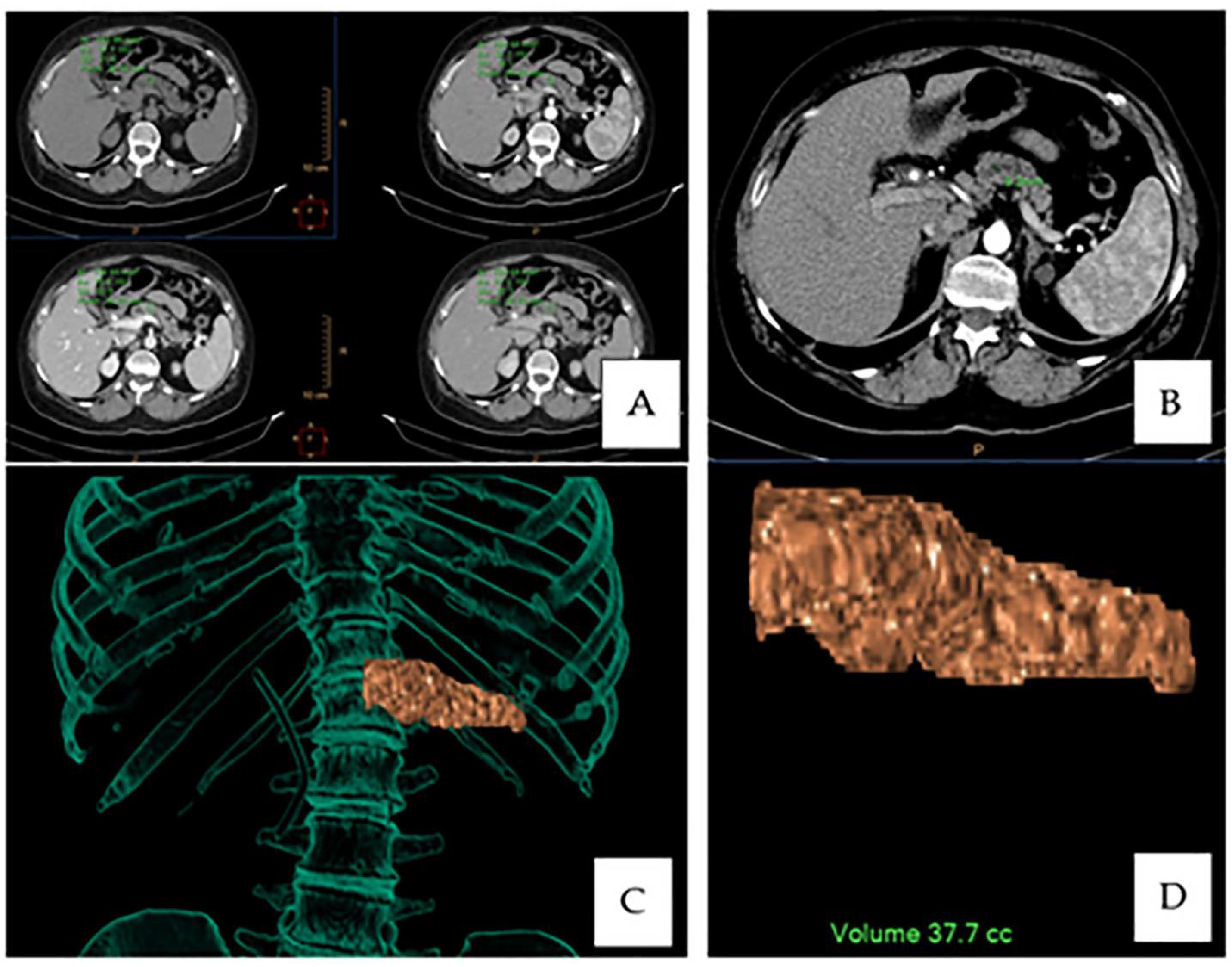 Medicina 57 00650 g001 550