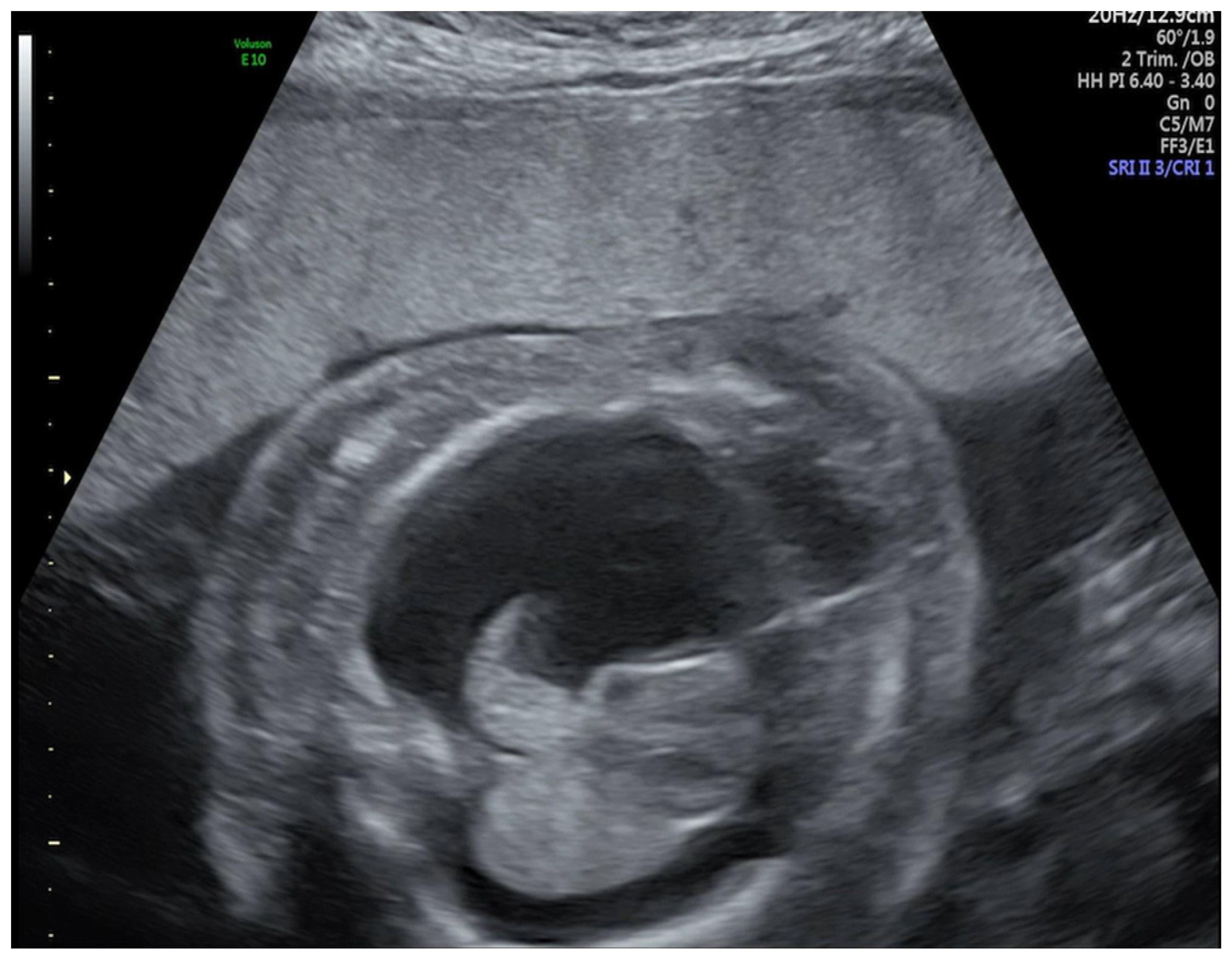 Medicina 57 00667 g001