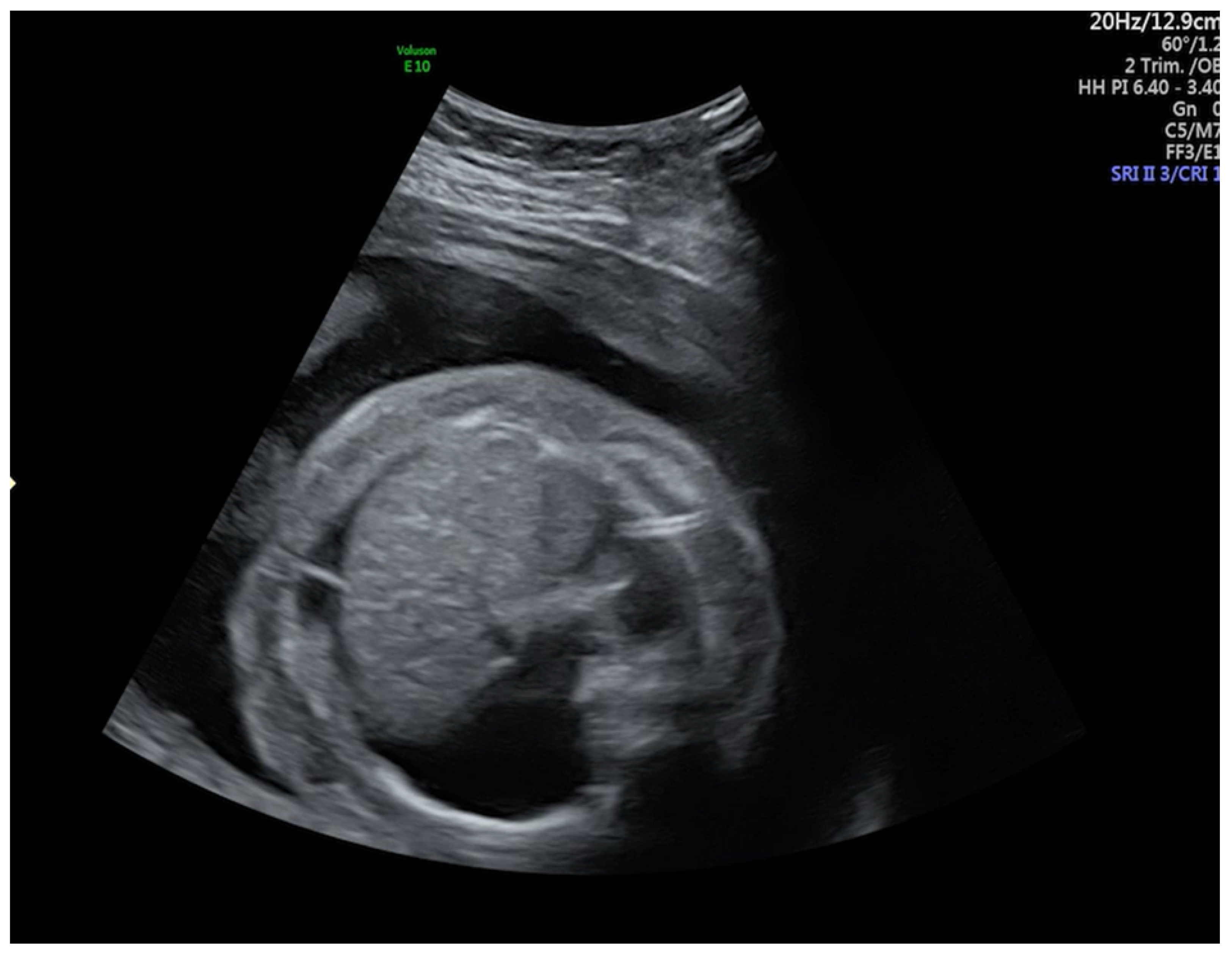 Medicina 57 00667 g002