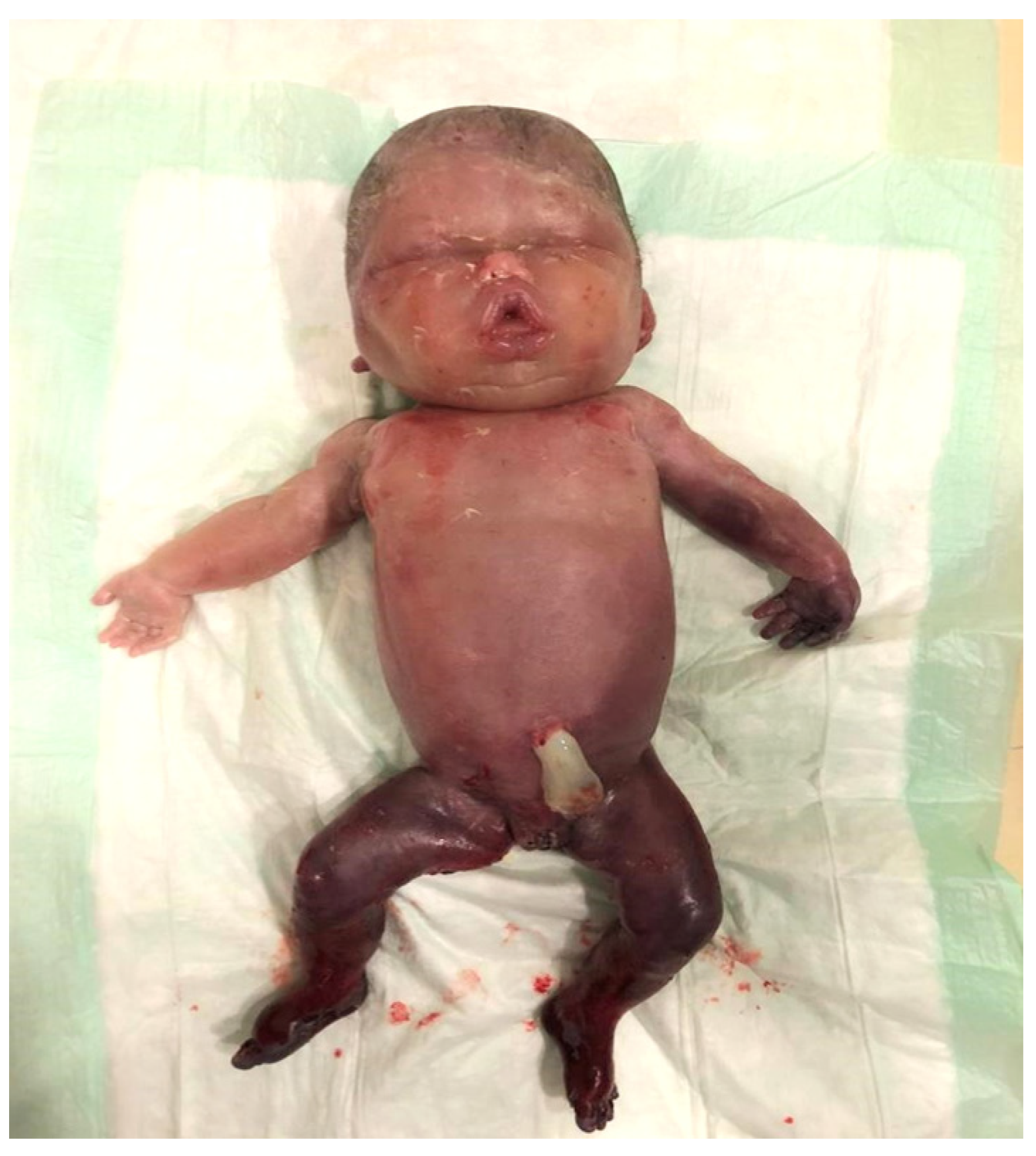 Medicina 57 00667 g003