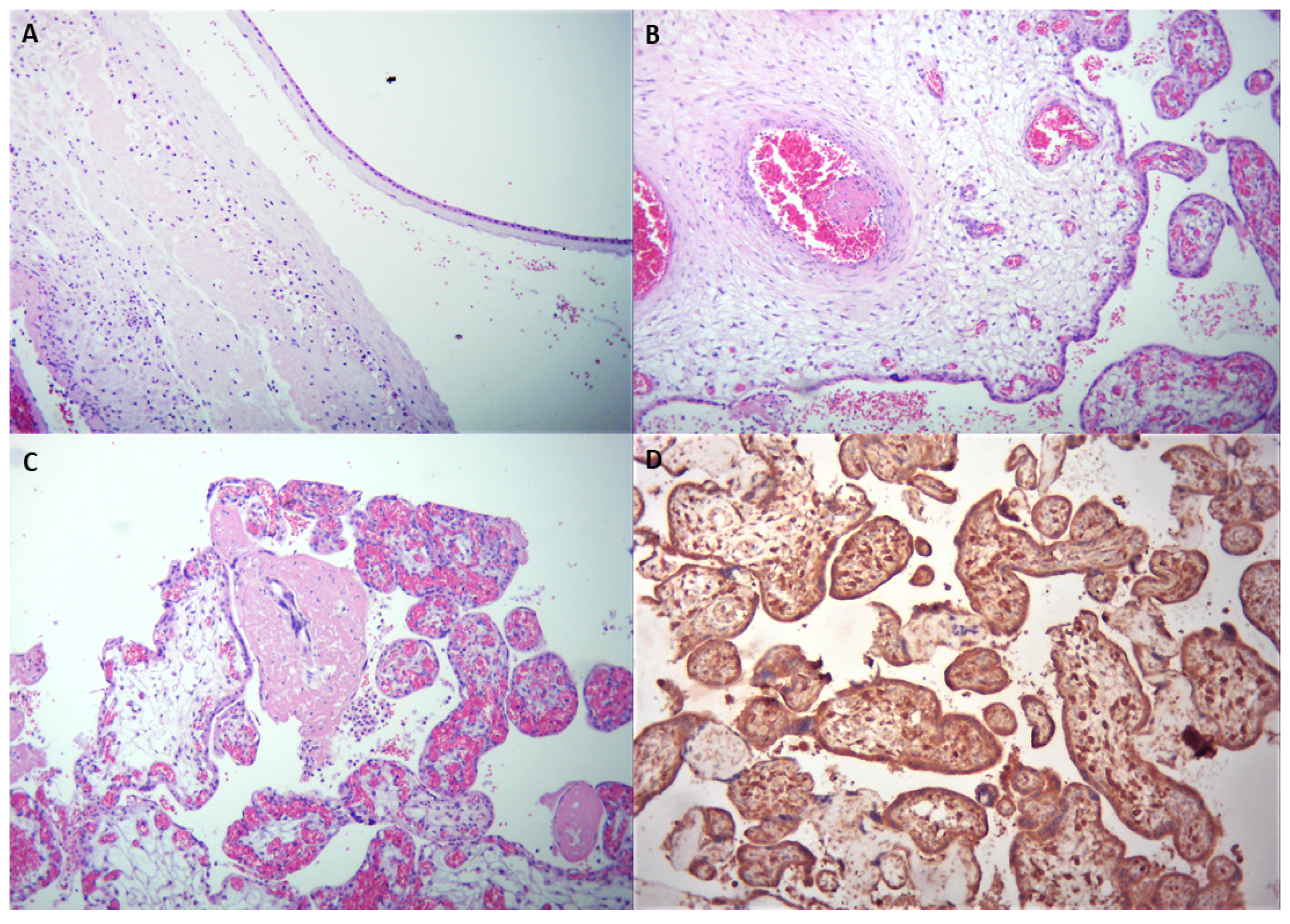 Medicina 57 00667 g004