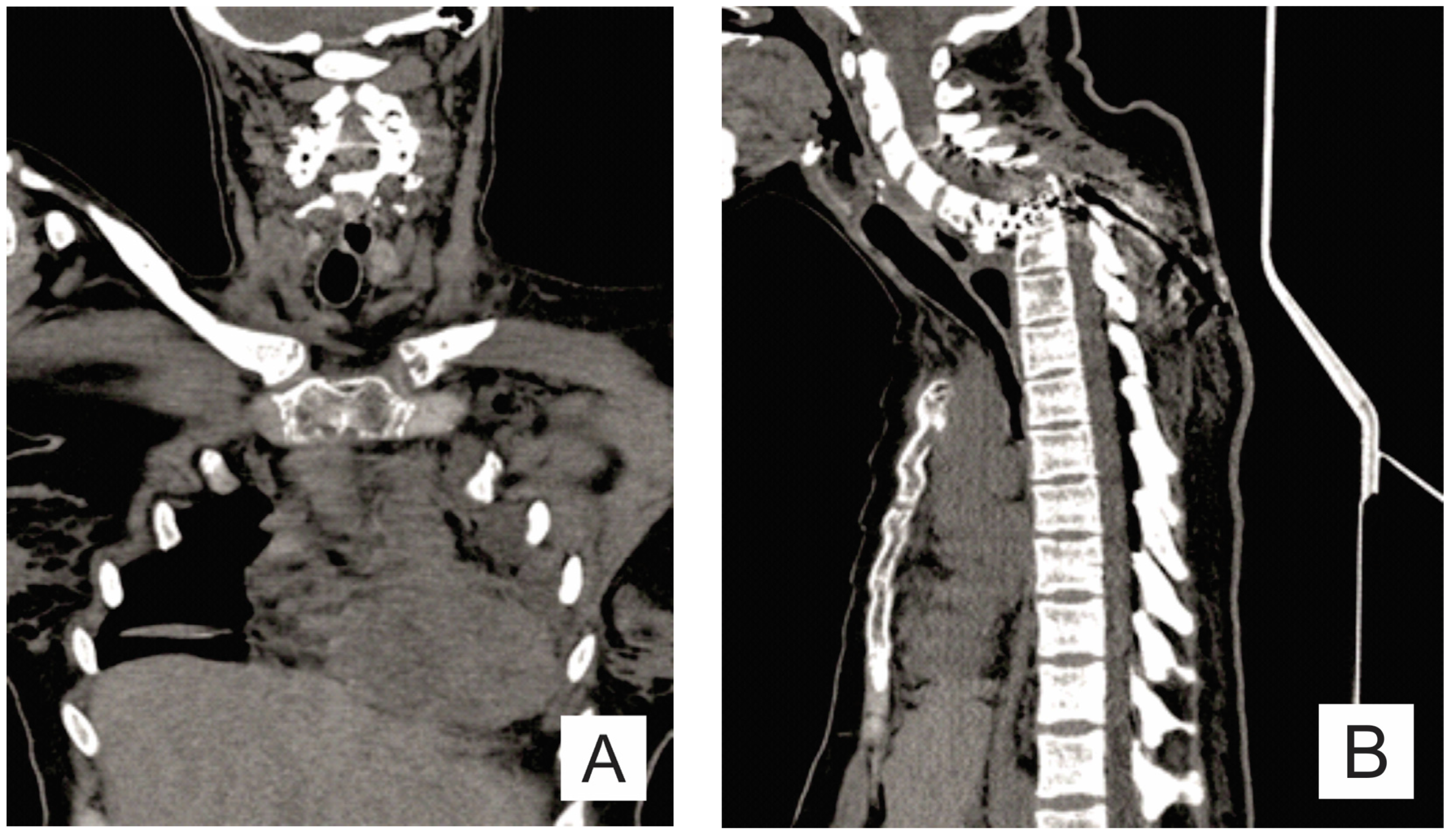 Medicina 57 00681 g003 550