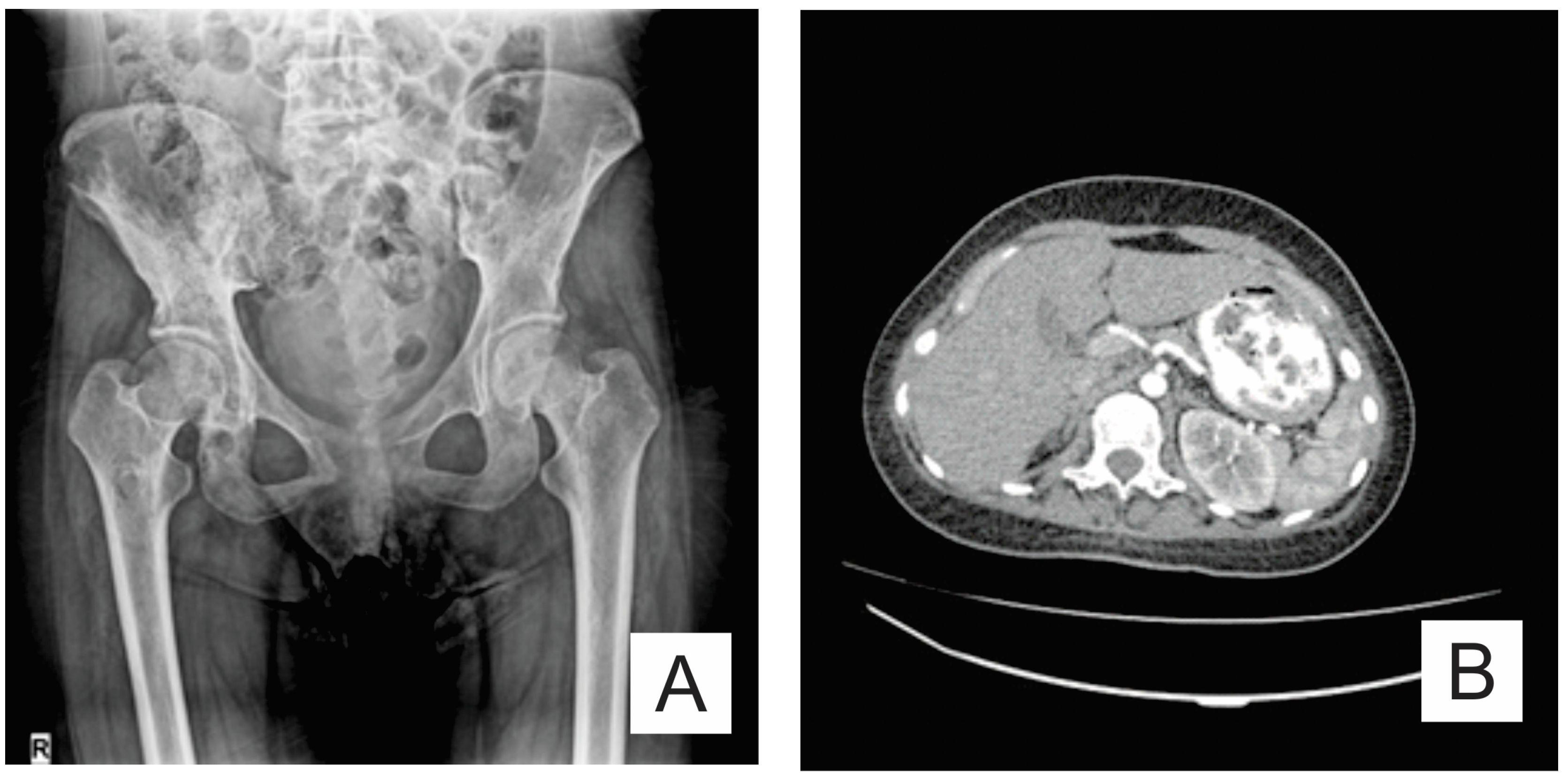 Medicina 57 00681 g004 550