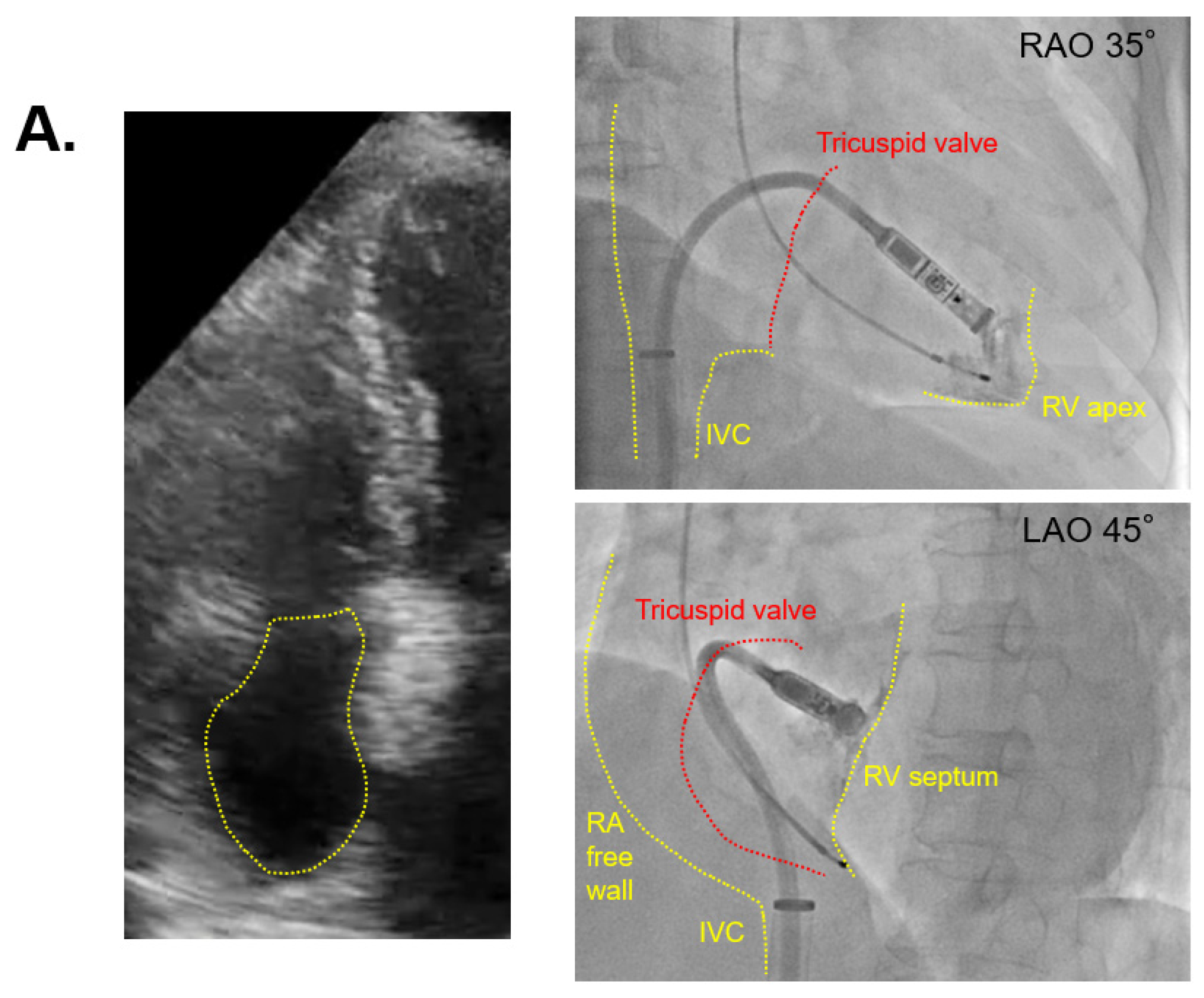 Medicina 57 00685 g003a