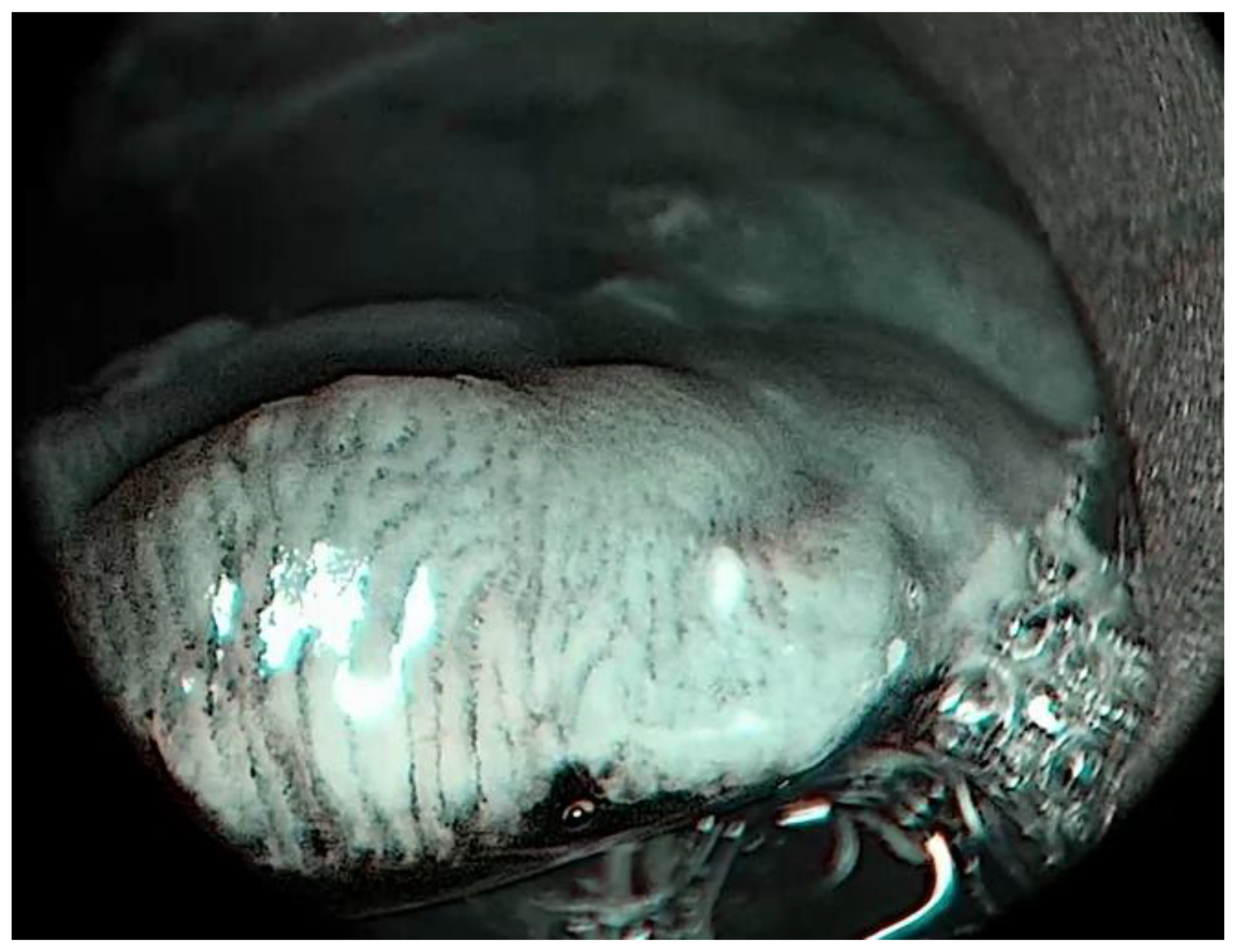 Medicina 57 00686 g003 550