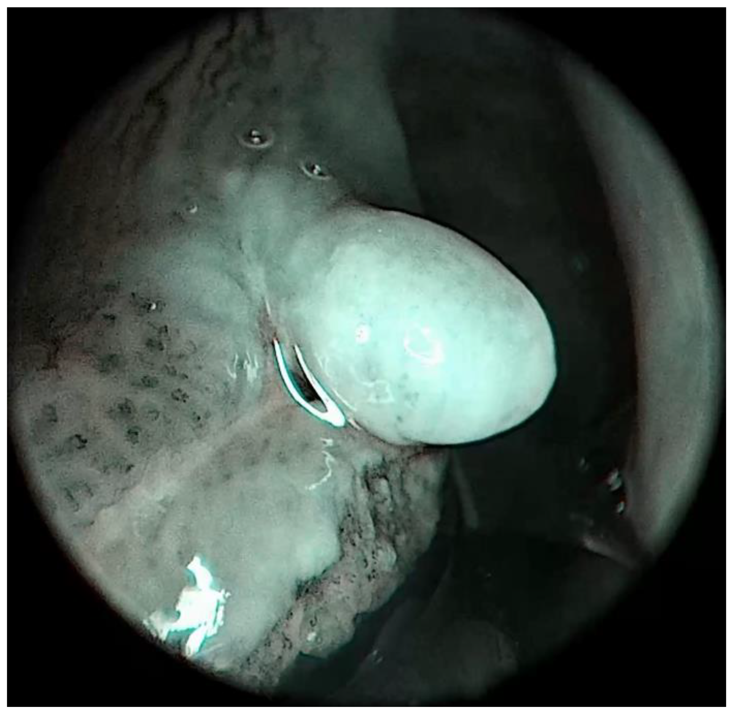 Medicina 57 00686 g004 550