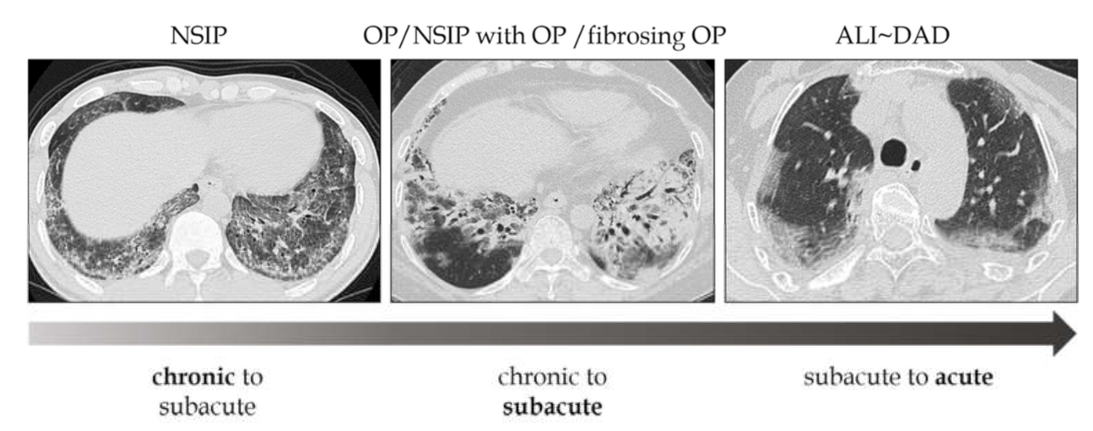 Medicina 57 00692 g002 Medicina 57 00692 g002