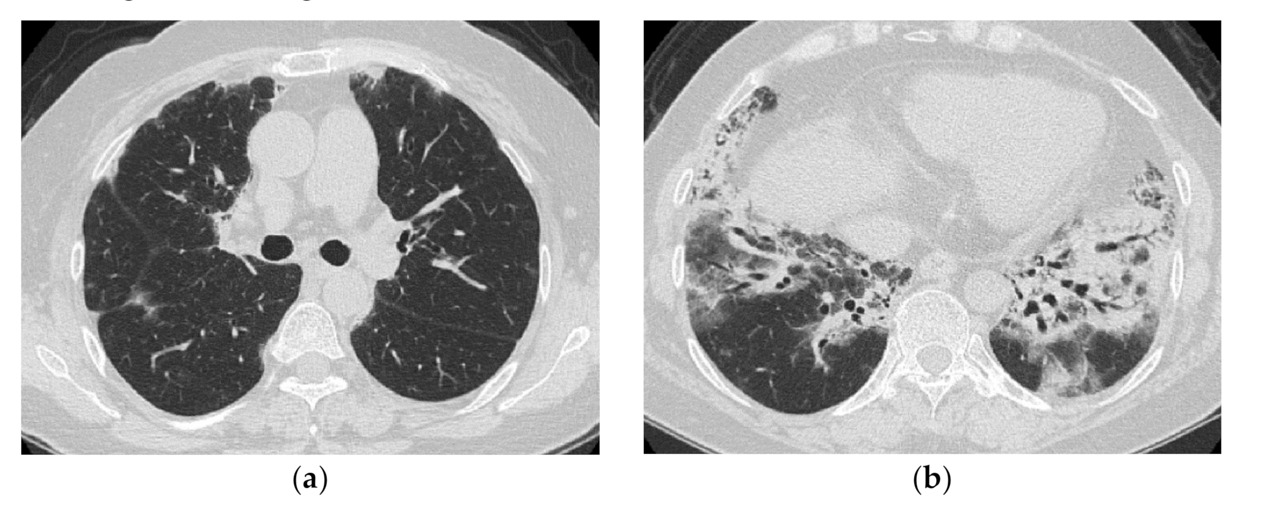 Medicina 57 00692 g004 Medicina 57 00692 g004