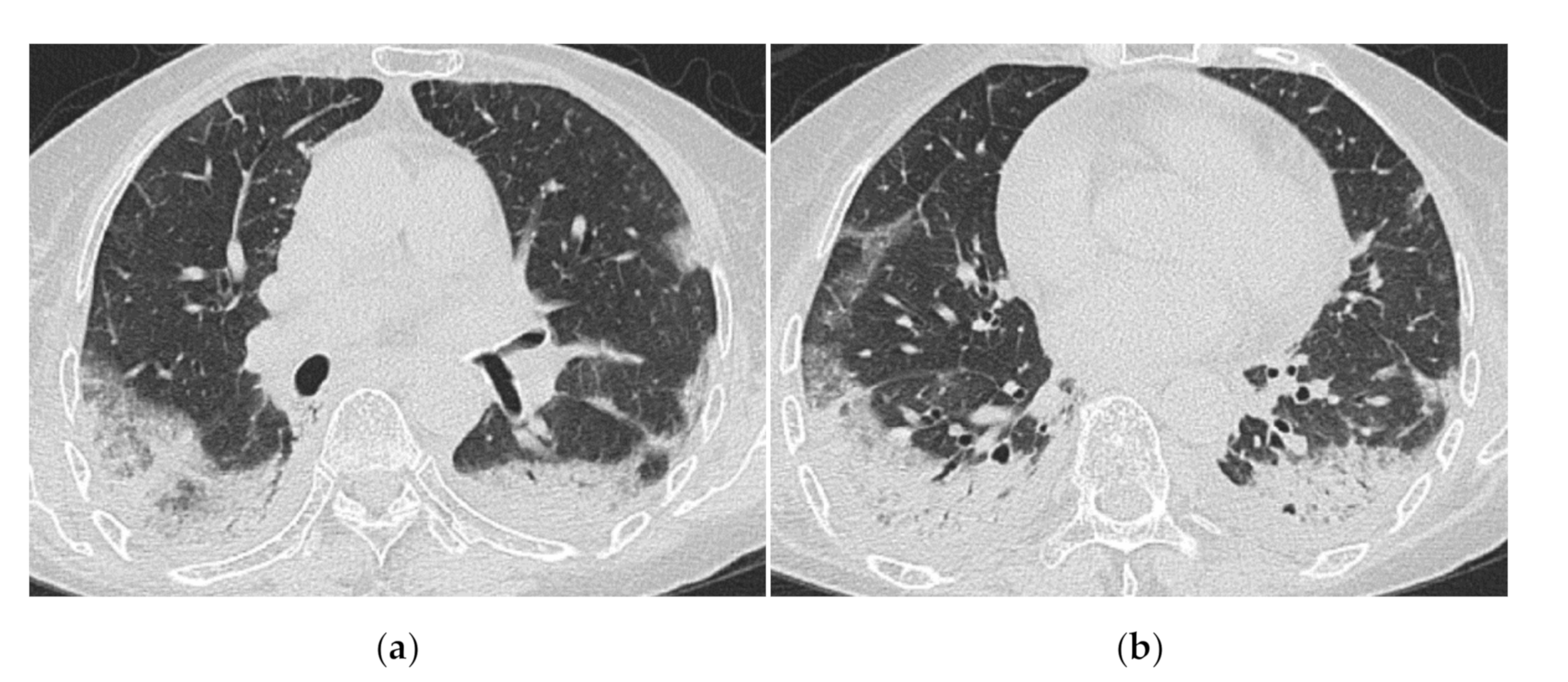 Medicina 57 00692 g007 Medicina 57 00692 g007