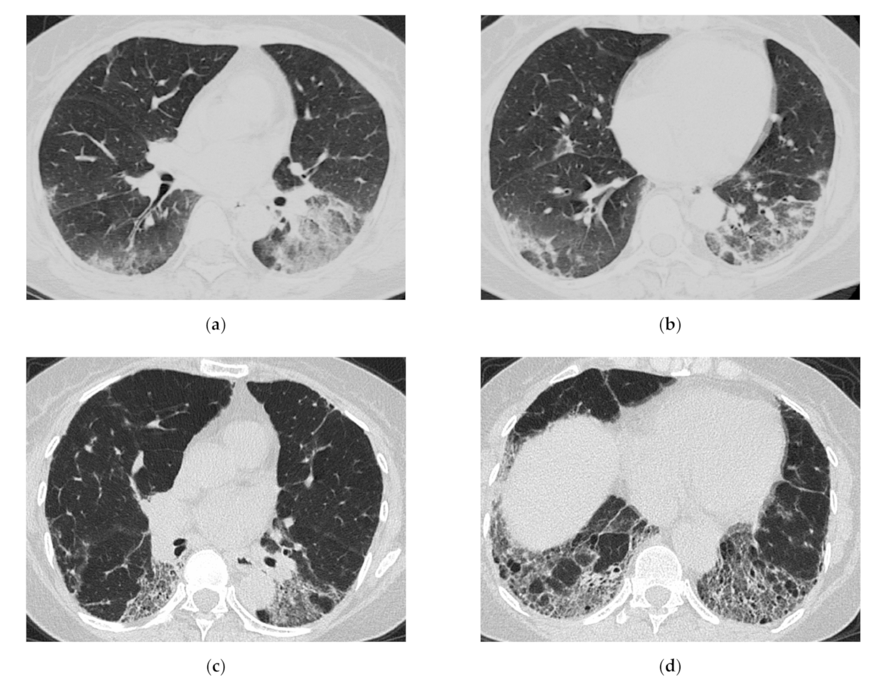 Medicina 57 00692 g008 Medicina 57 00692 g008