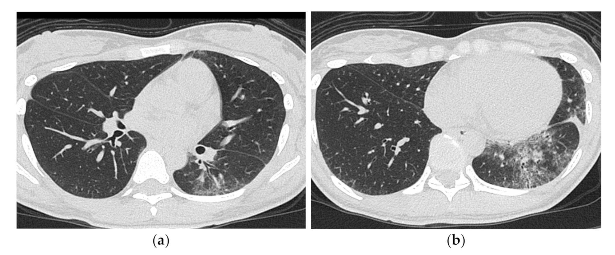 Medicina 57 00692 g009 Medicina 57 00692 g009