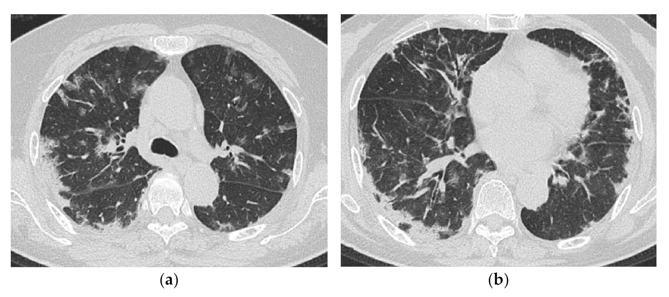 Medicina 57 00692 g012 Medicina 57 00692 g012