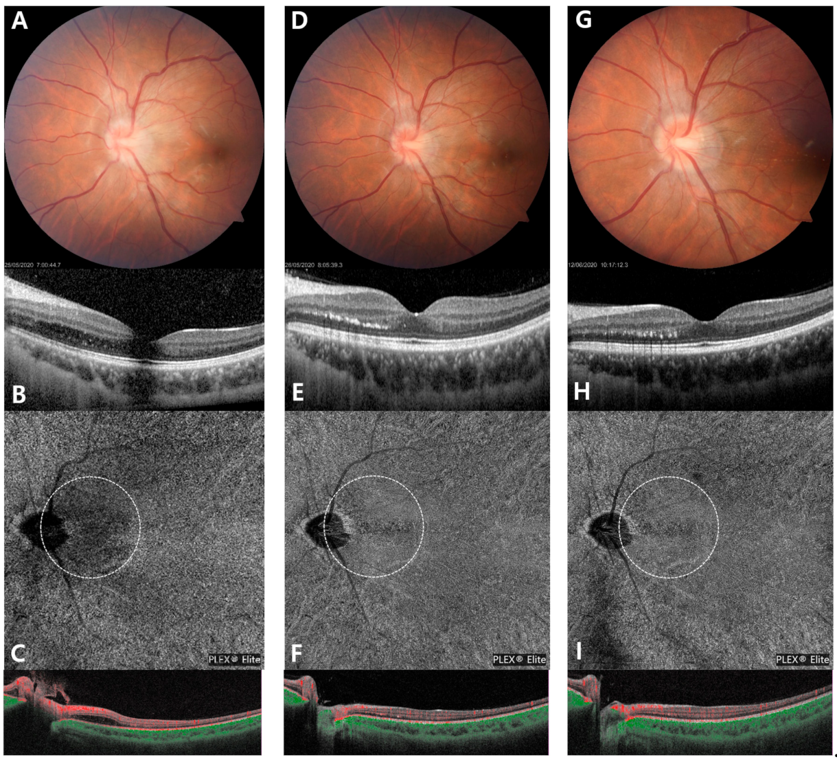 Medicina 57 00697 g002 550