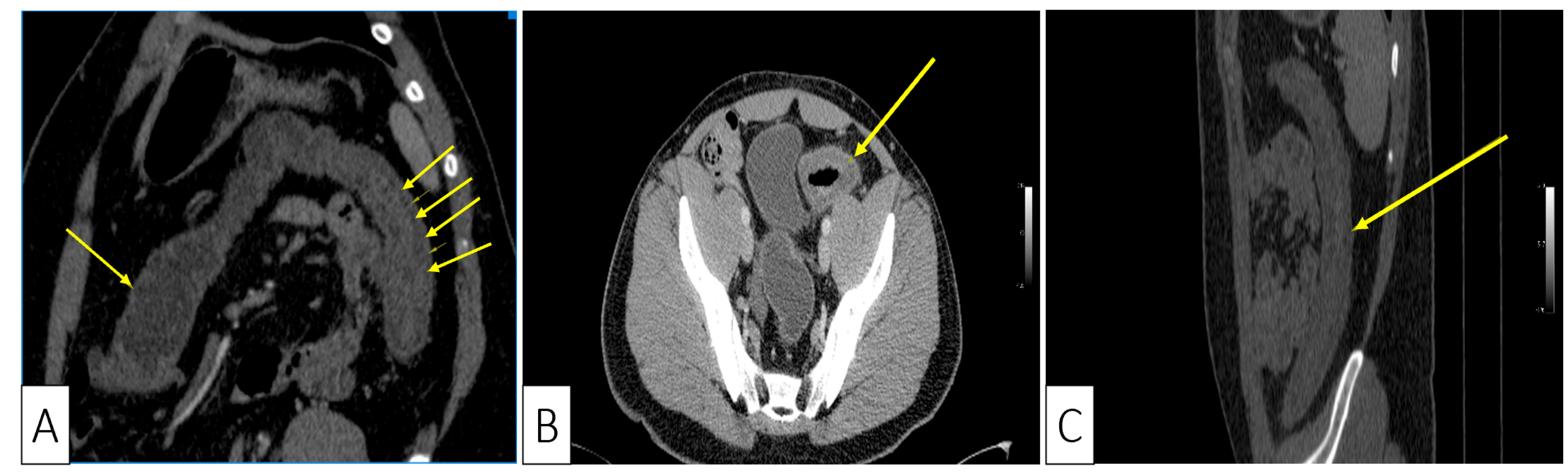 Medicina 57 00705 g003 Medicina 57 00705 g003
