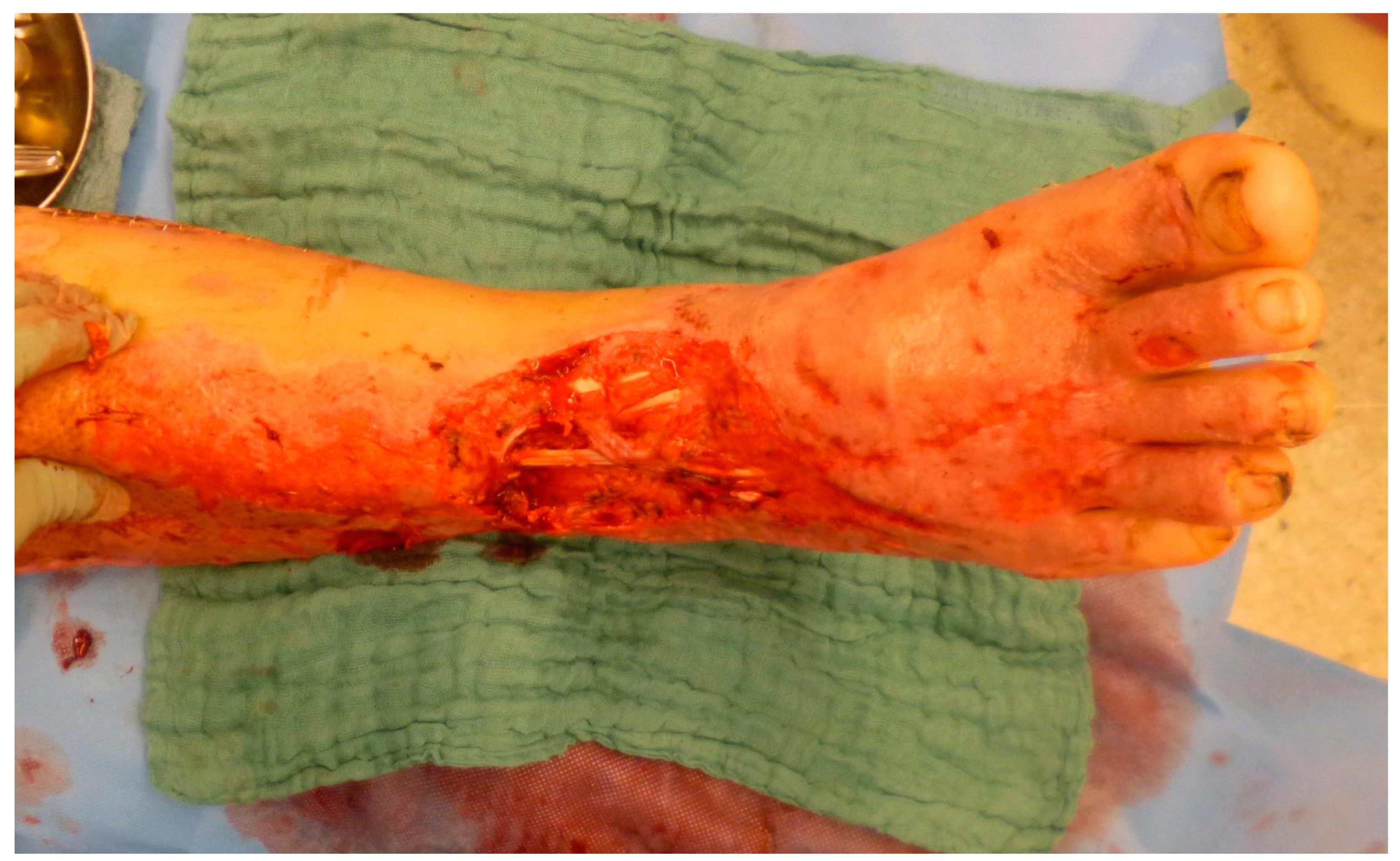 Medicina 57 00718 g001