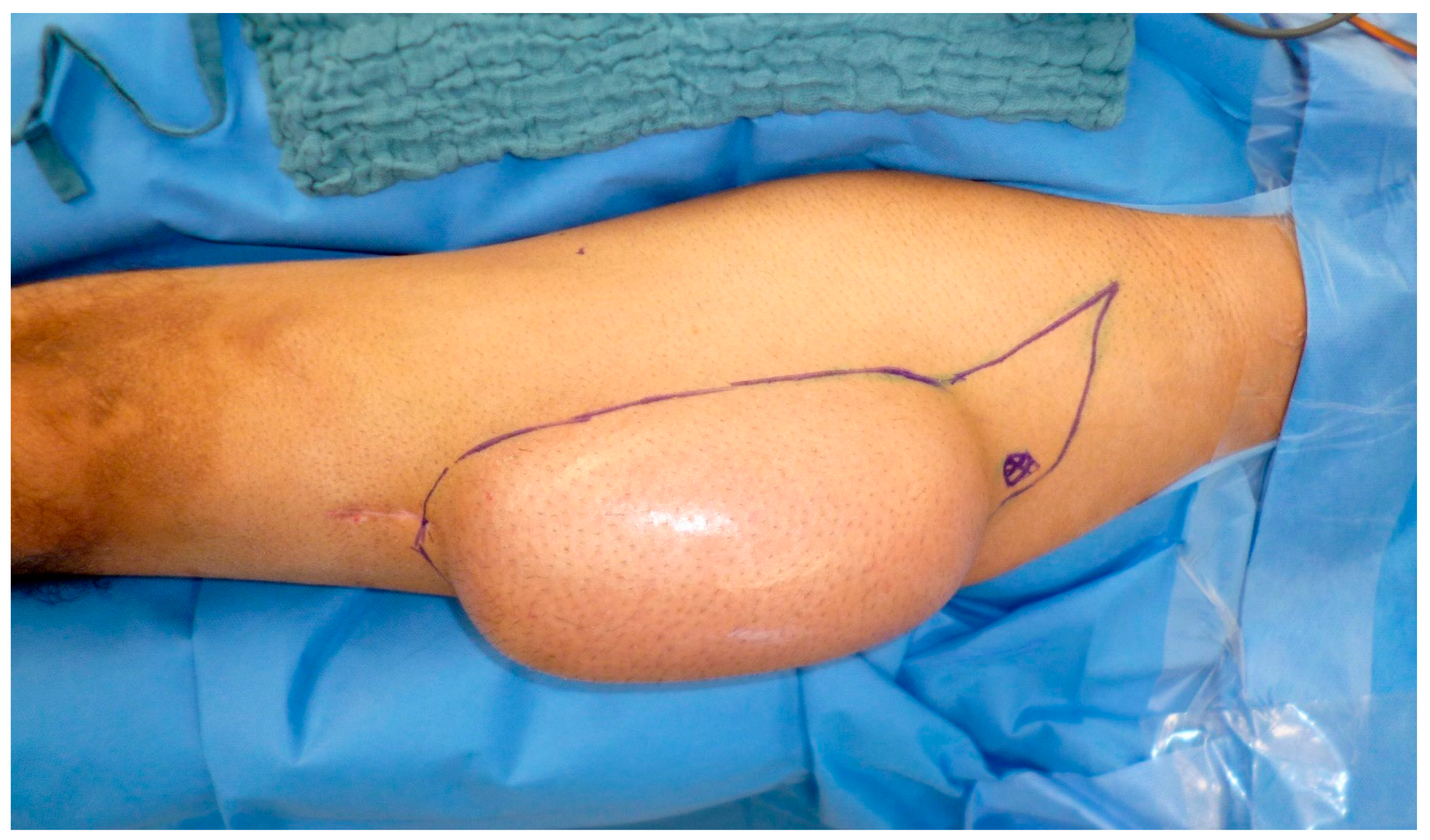 Medicina 57 00718 g005