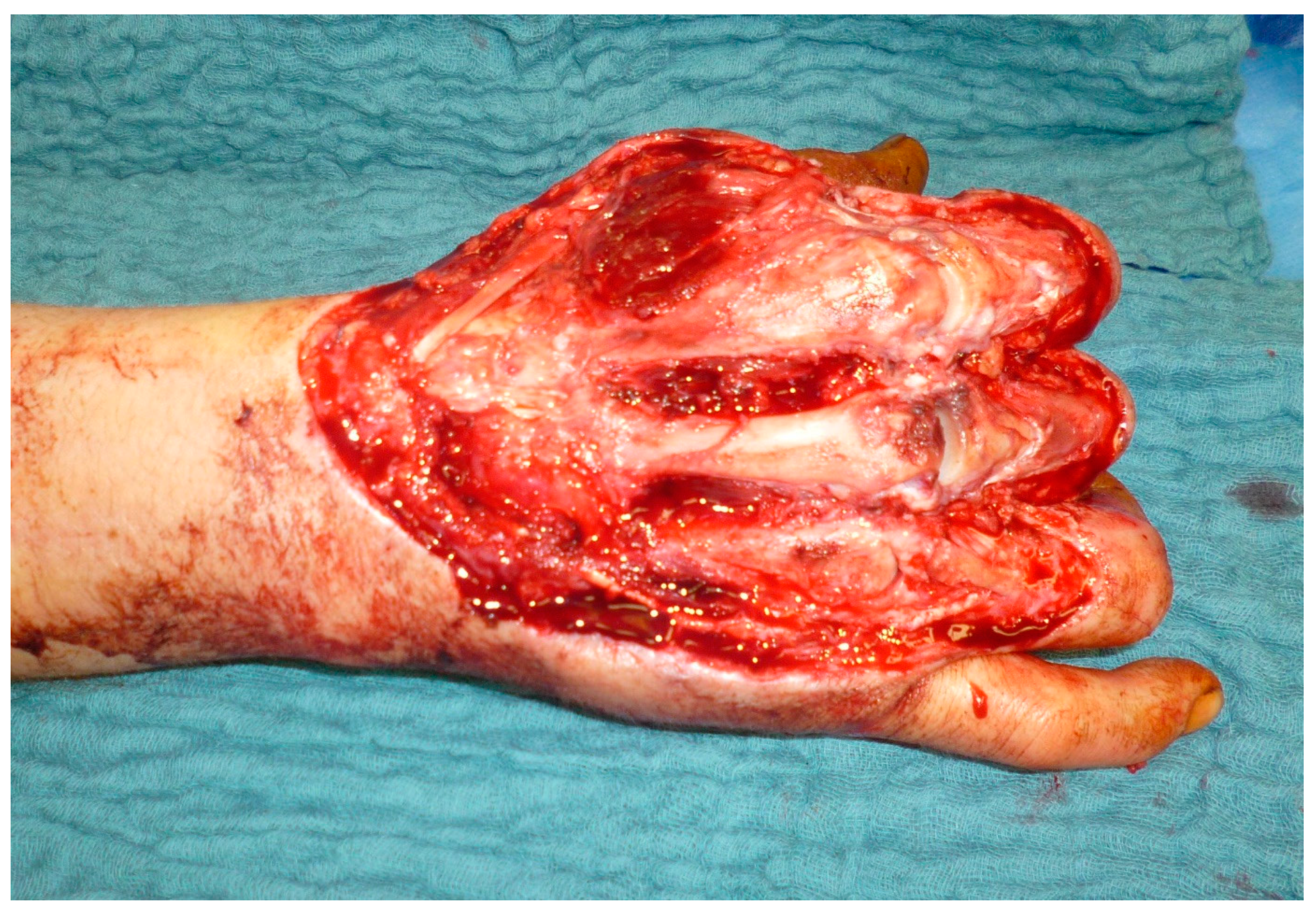 Medicina 57 00718 g007