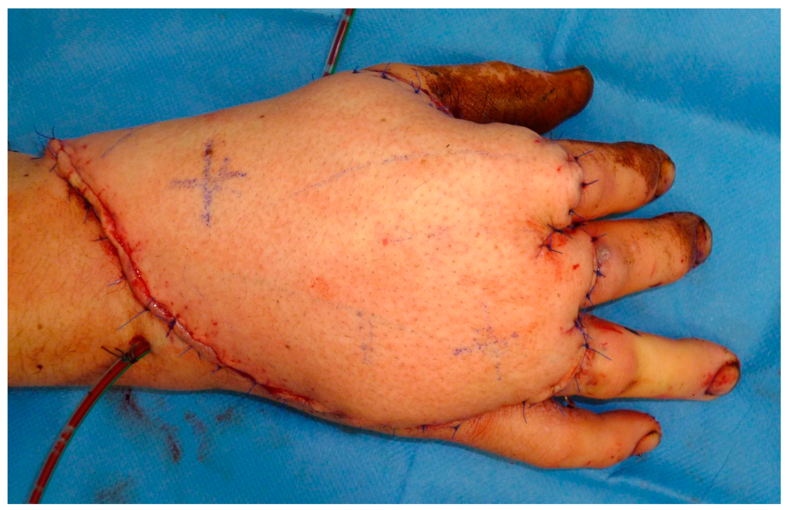 Medicina 57 00718 g008