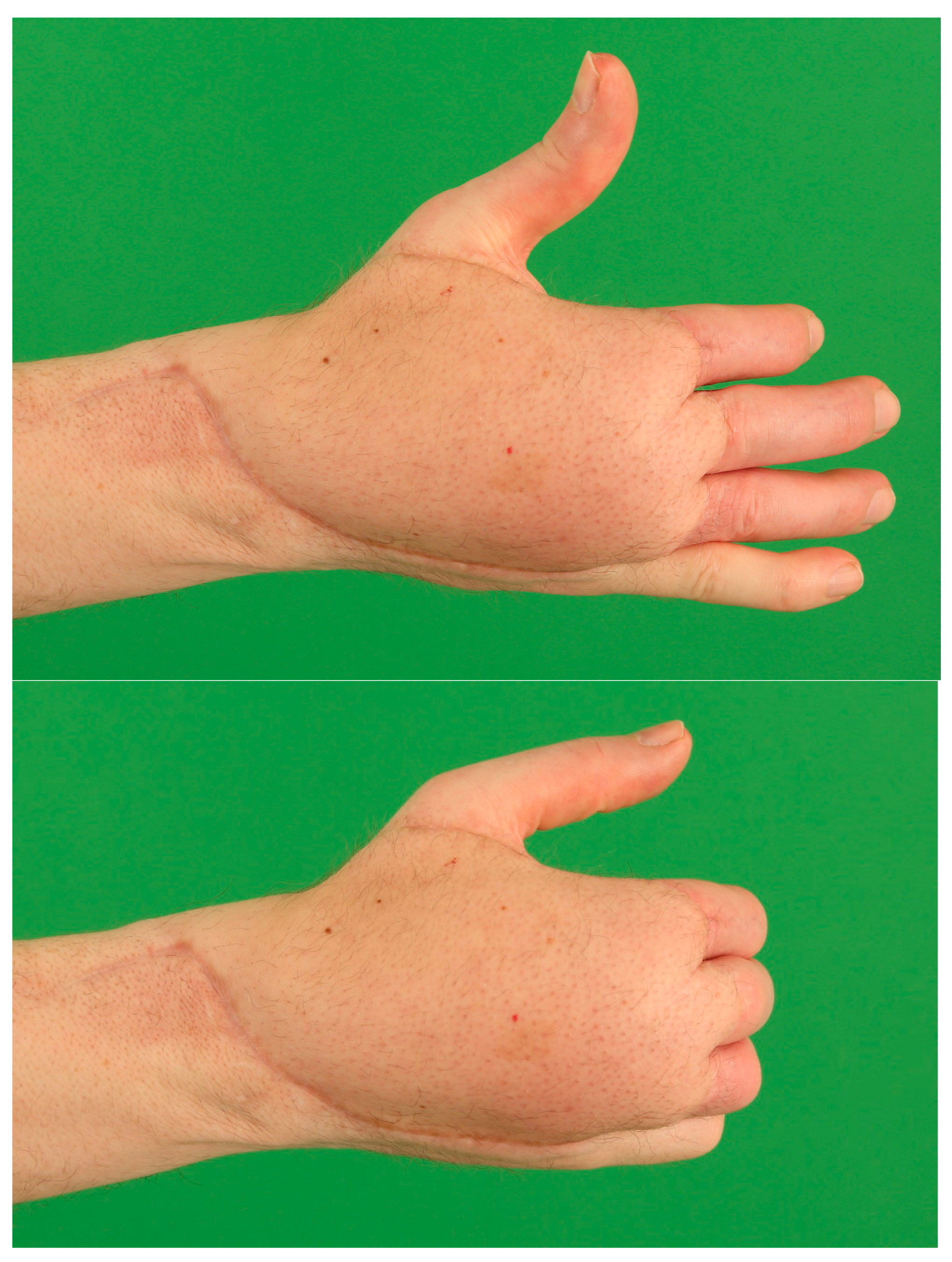 Medicina 57 00718 g009