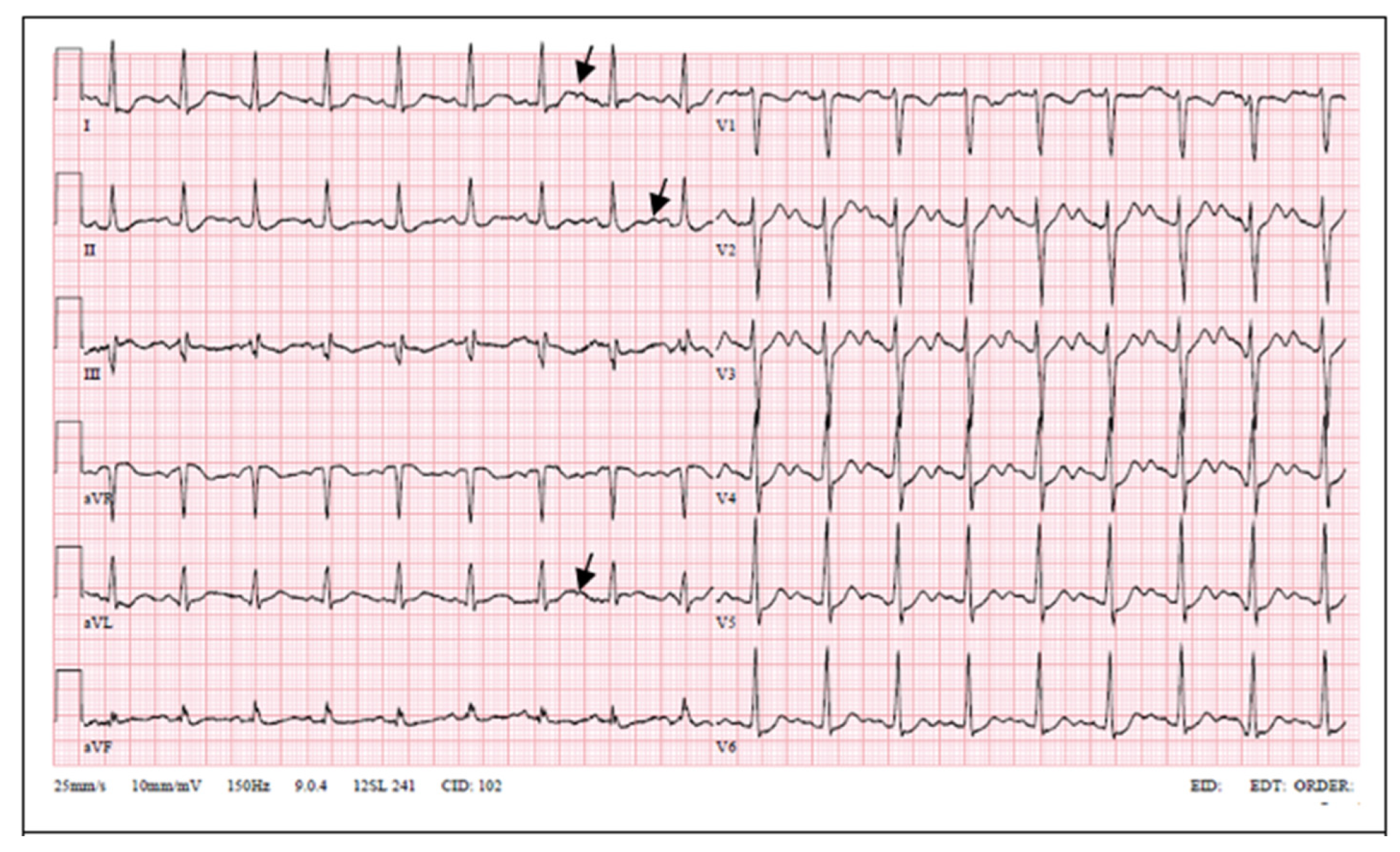 Medicina 57 00721 g002 550