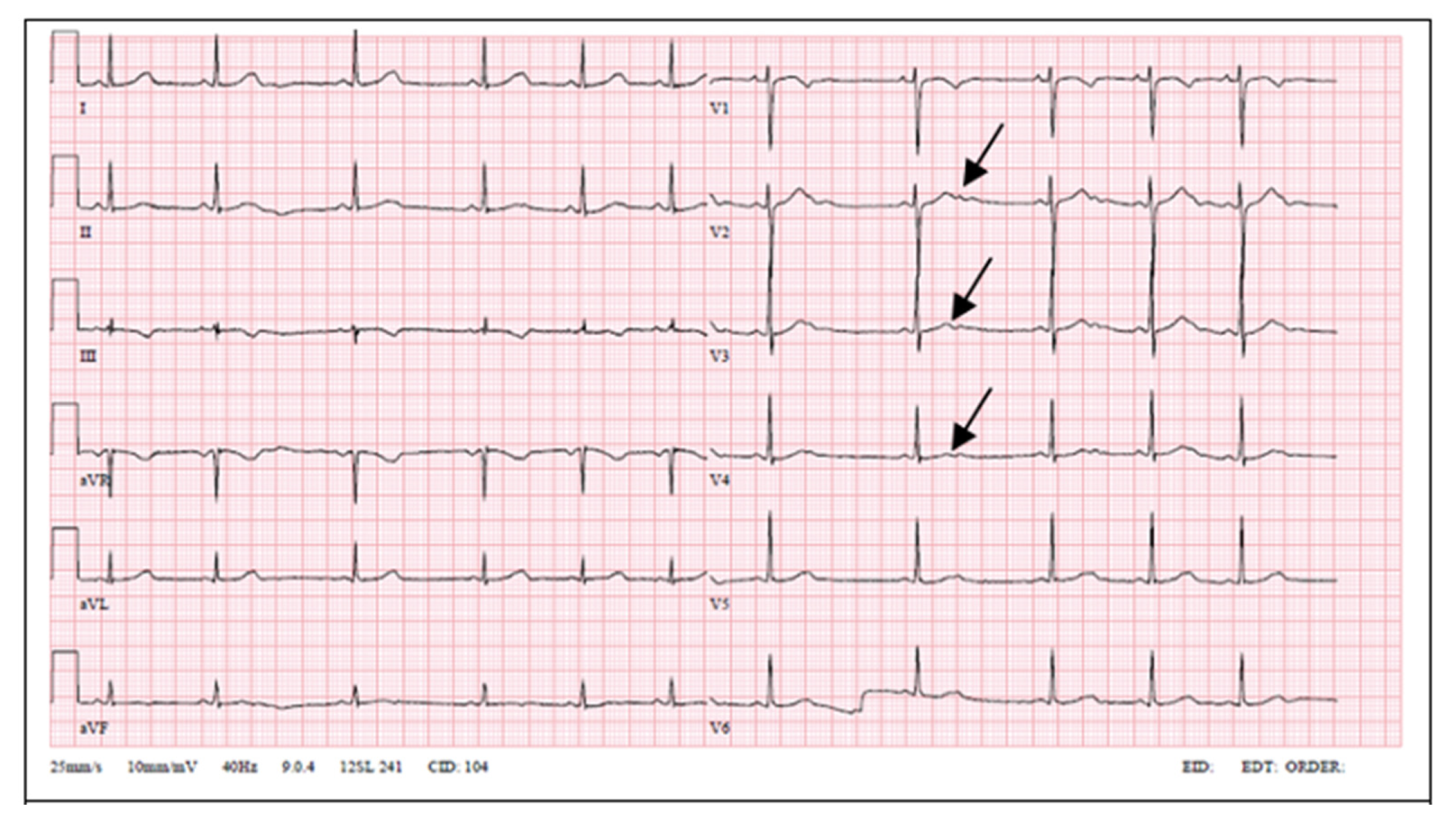 Medicina 57 00721 g004 550