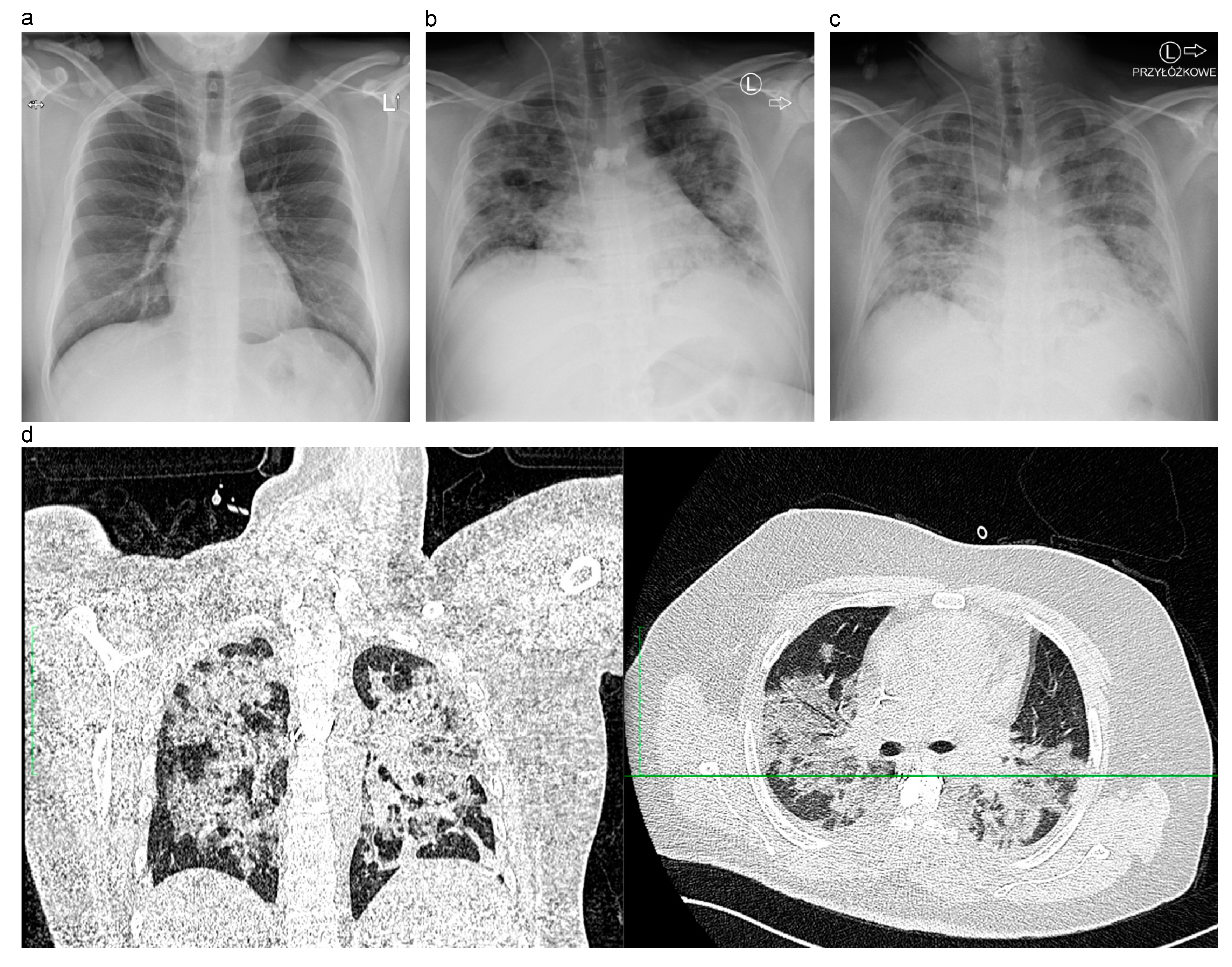 Medicina 57 00724 g001