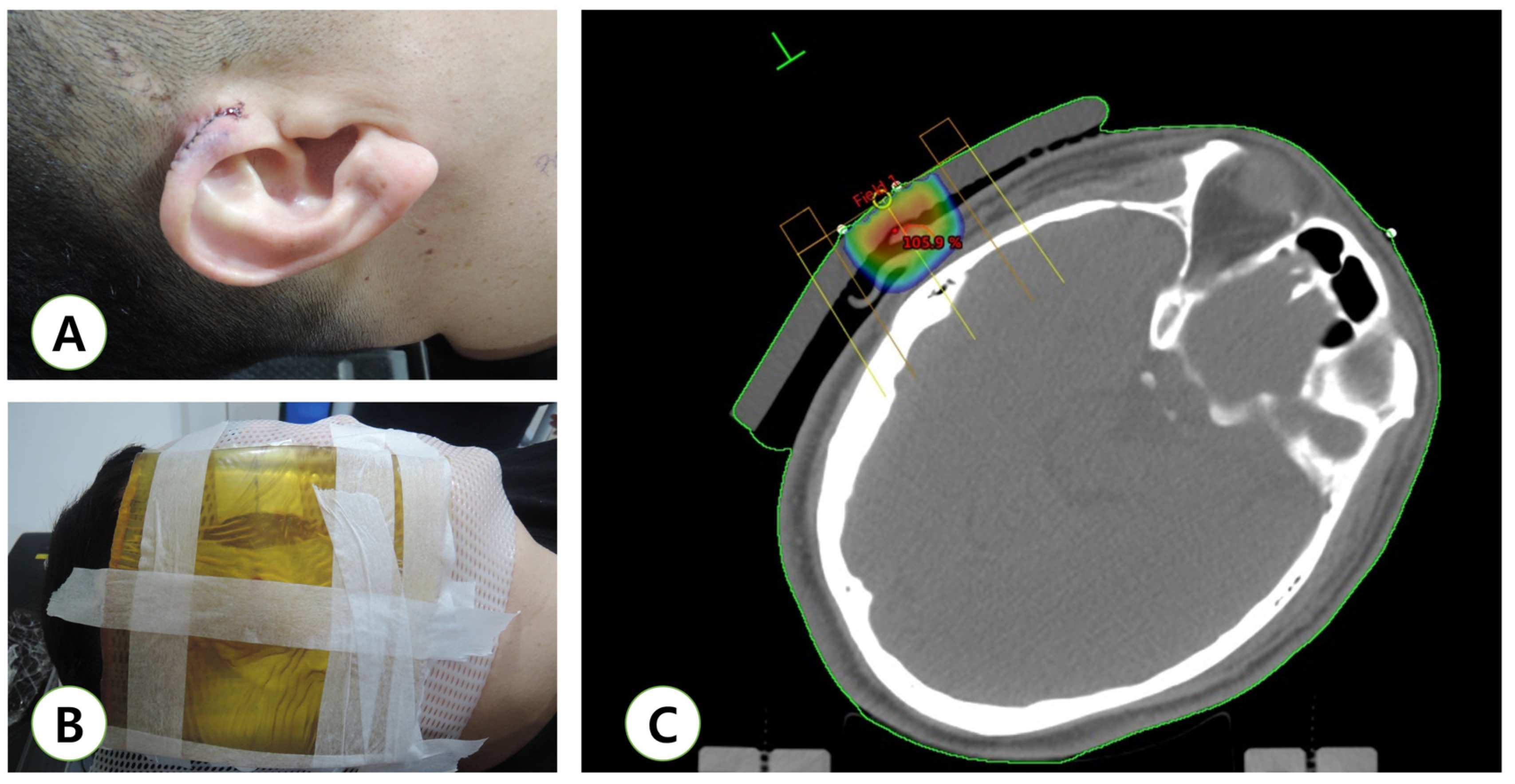 Medicina 57 00730 g001 550