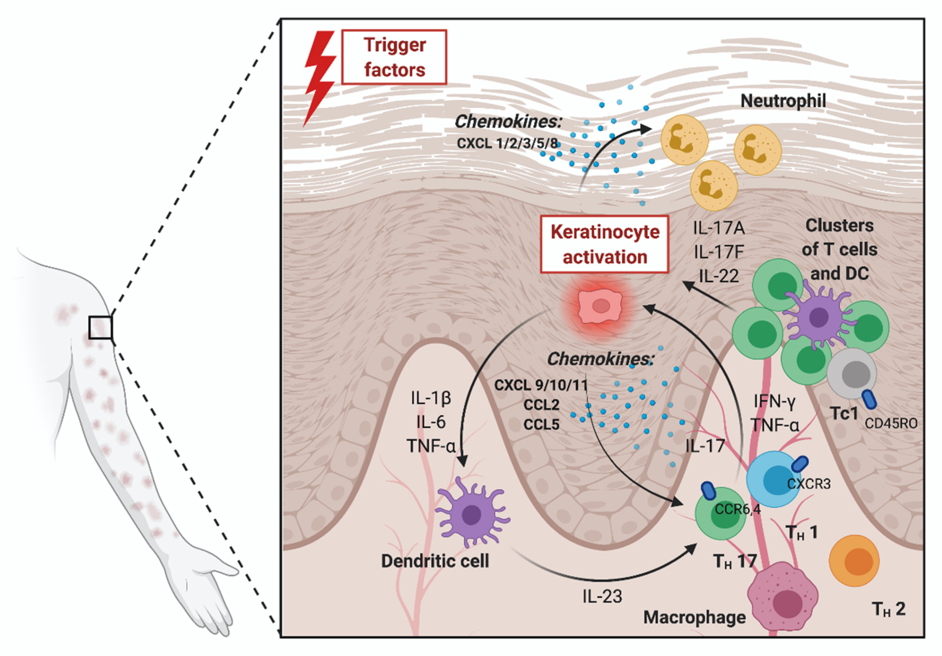 Medicina | Free Full-Text | The Role of Chemokines in Psoriasis—An