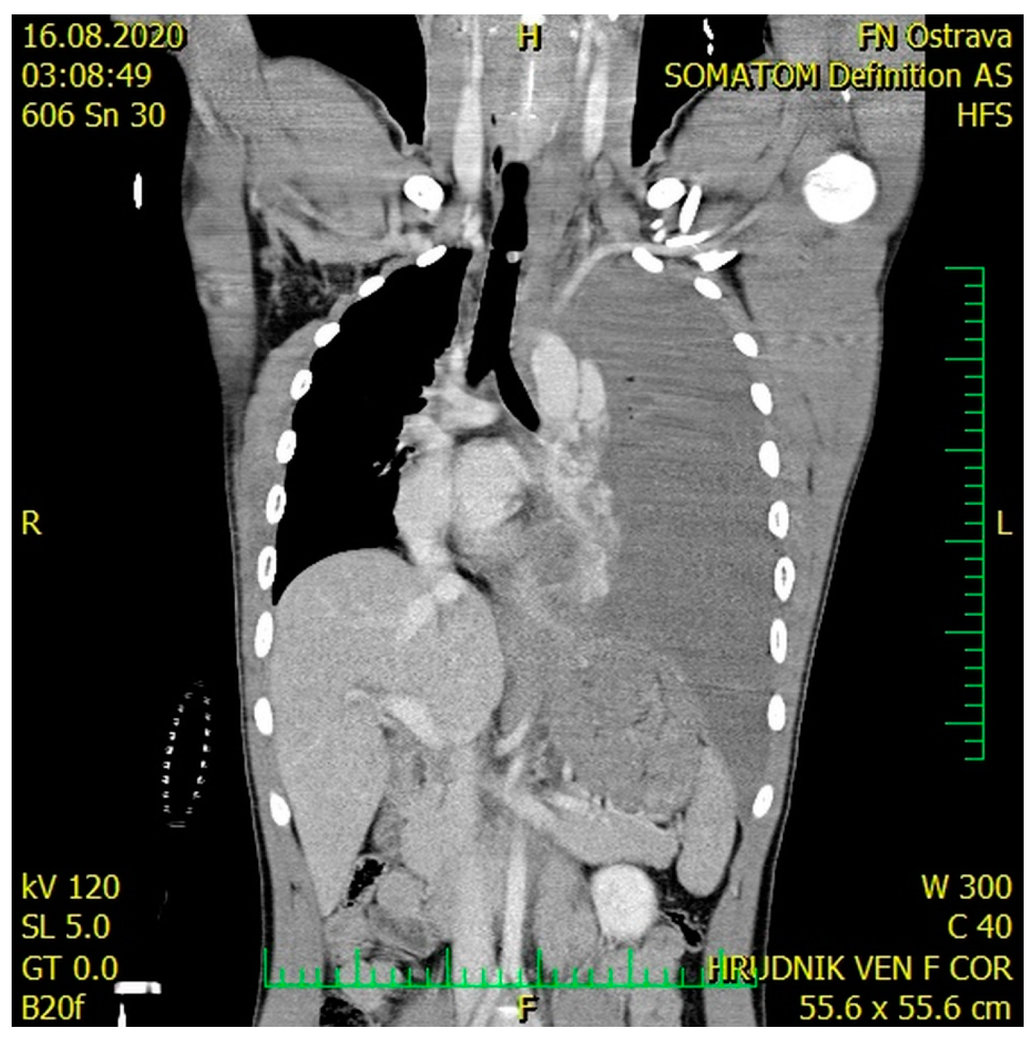 Medicina 57 00790 g002