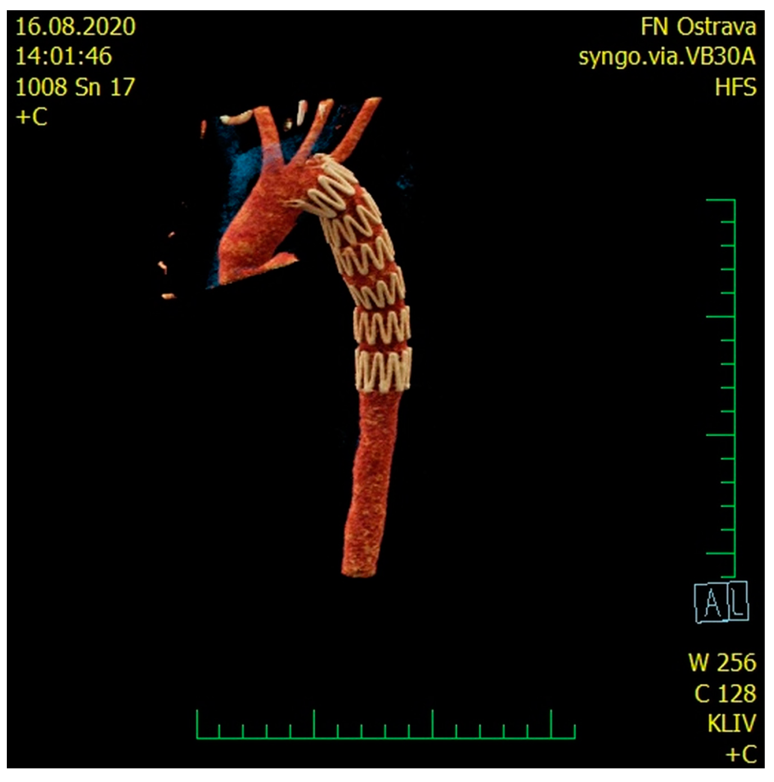 Medicina 57 00790 g003