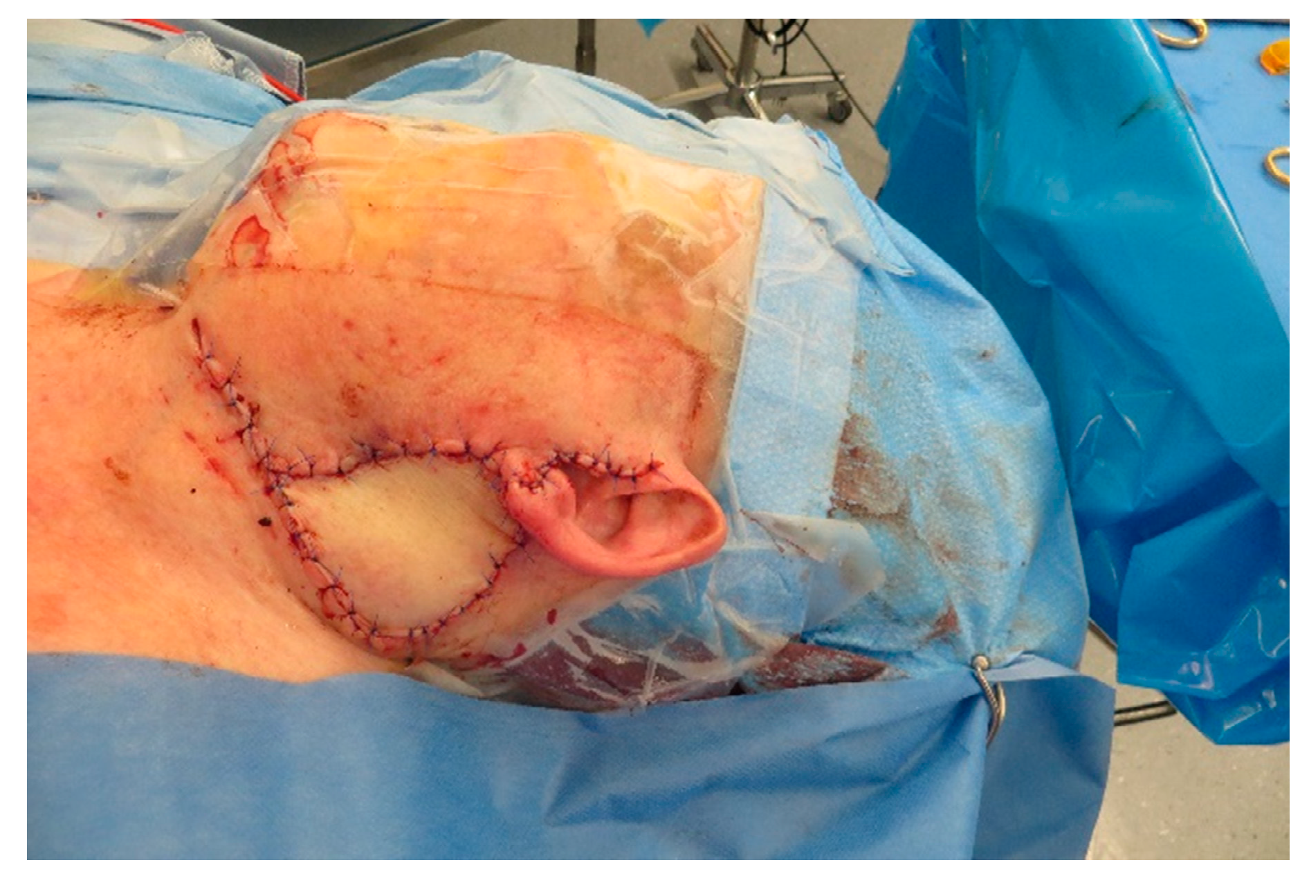 Medicina 57 00795 g0a13 550