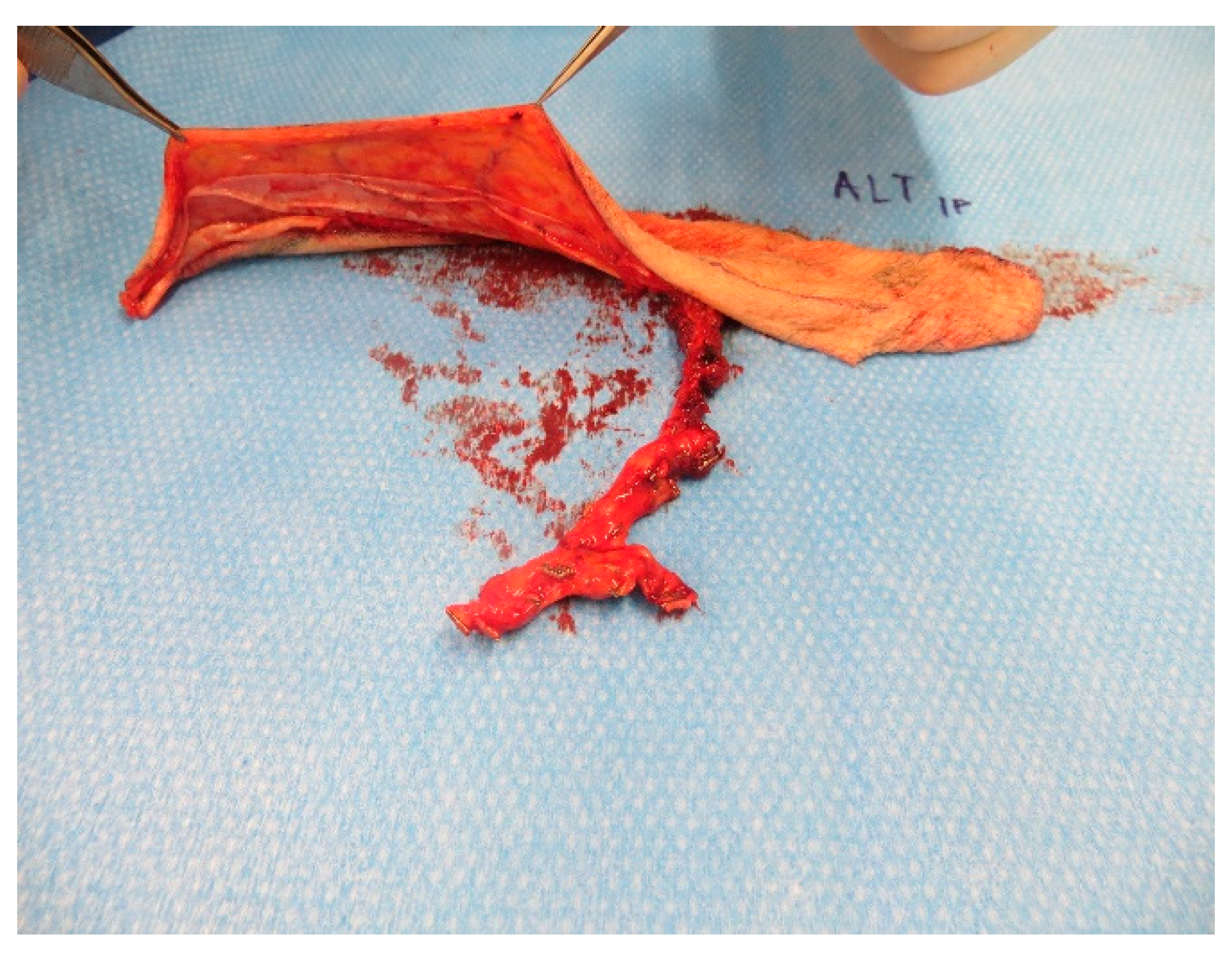 Medicina 57 00795 g0a17 550