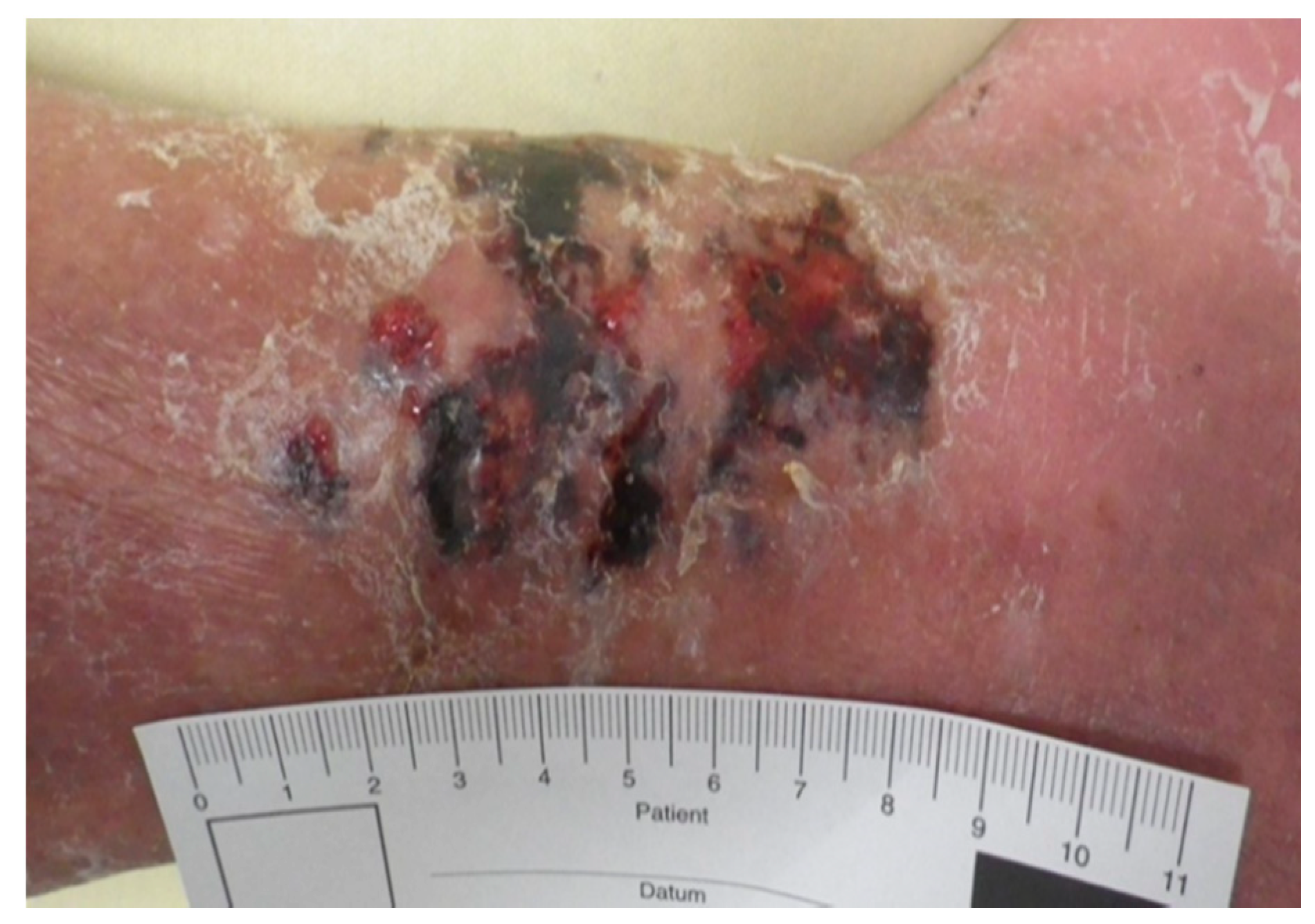 Medicina 57 00795 g0a3 550