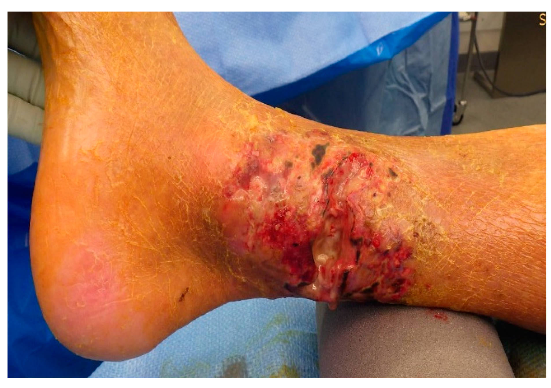 Medicina 57 00795 g0a4 550