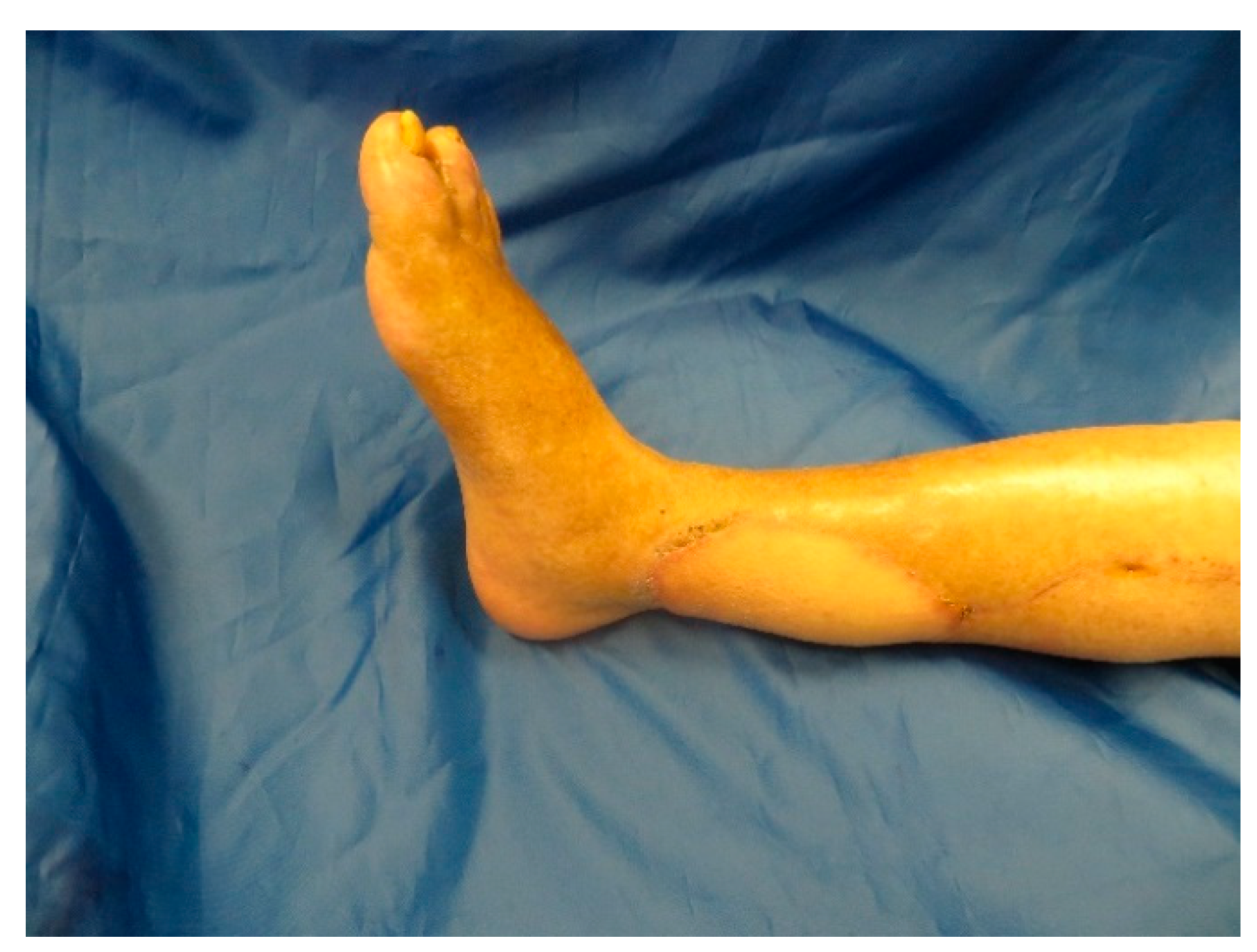 Medicina 57 00795 g0a9 550