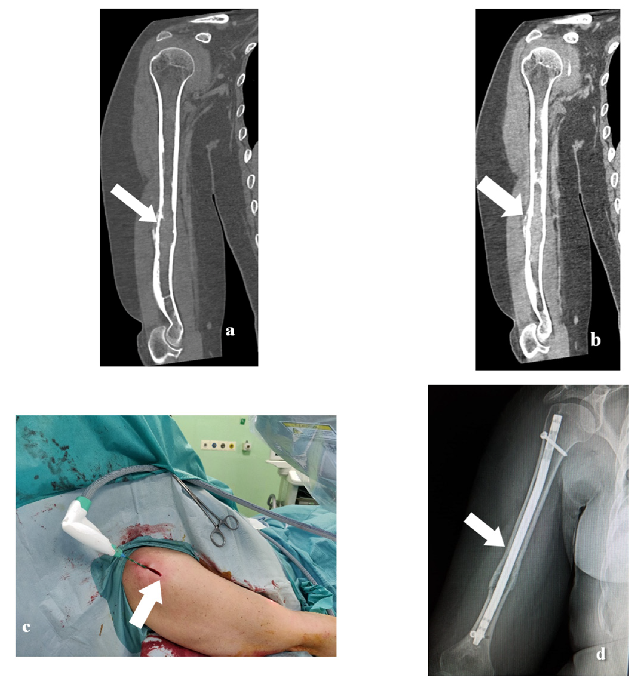 Medicina 57 00825 g003 550