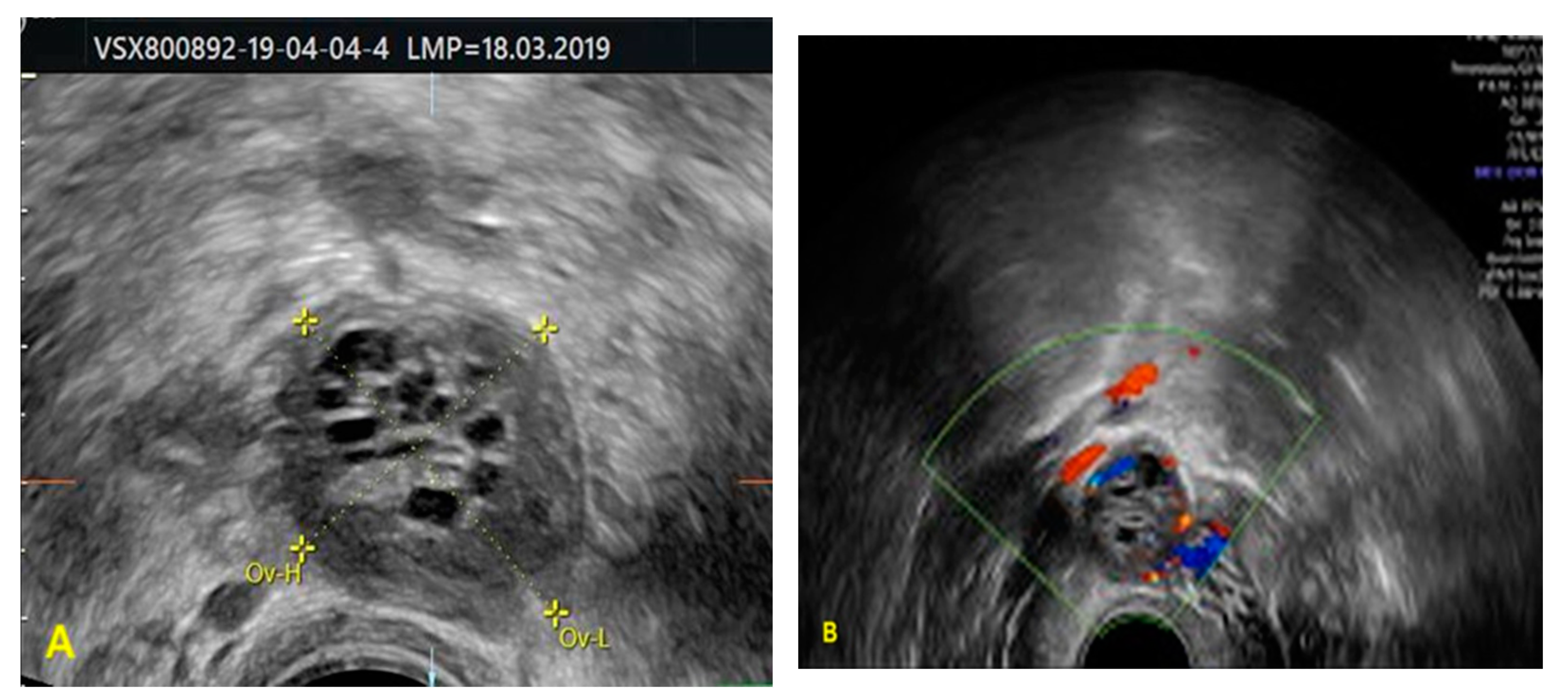 Medicina 57 00829 g001 550