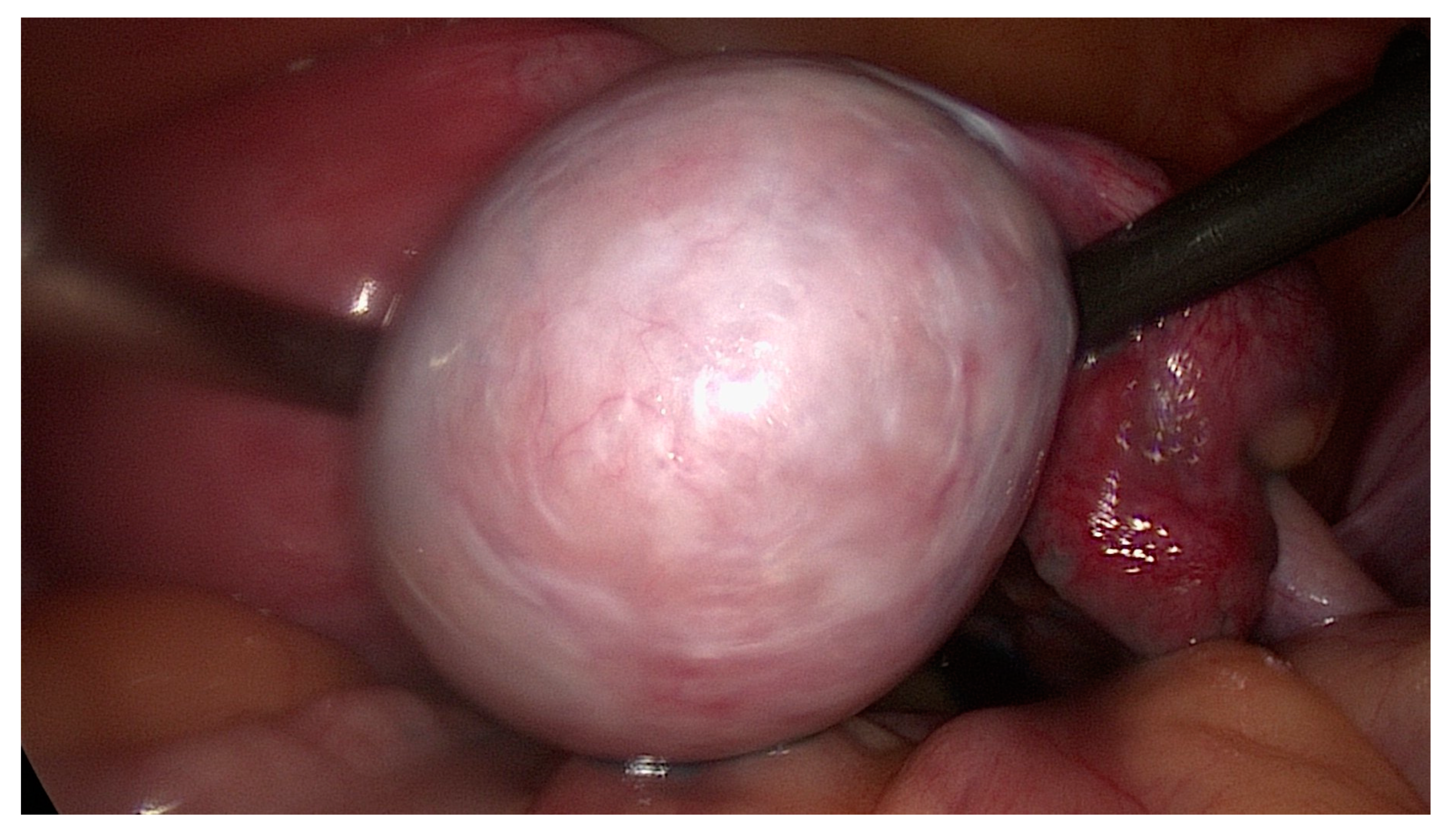 Medicina 57 00829 g002 550