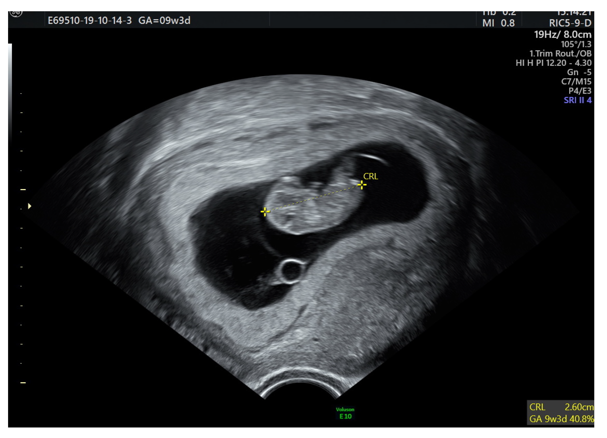 Medicina 57 00829 g003 550