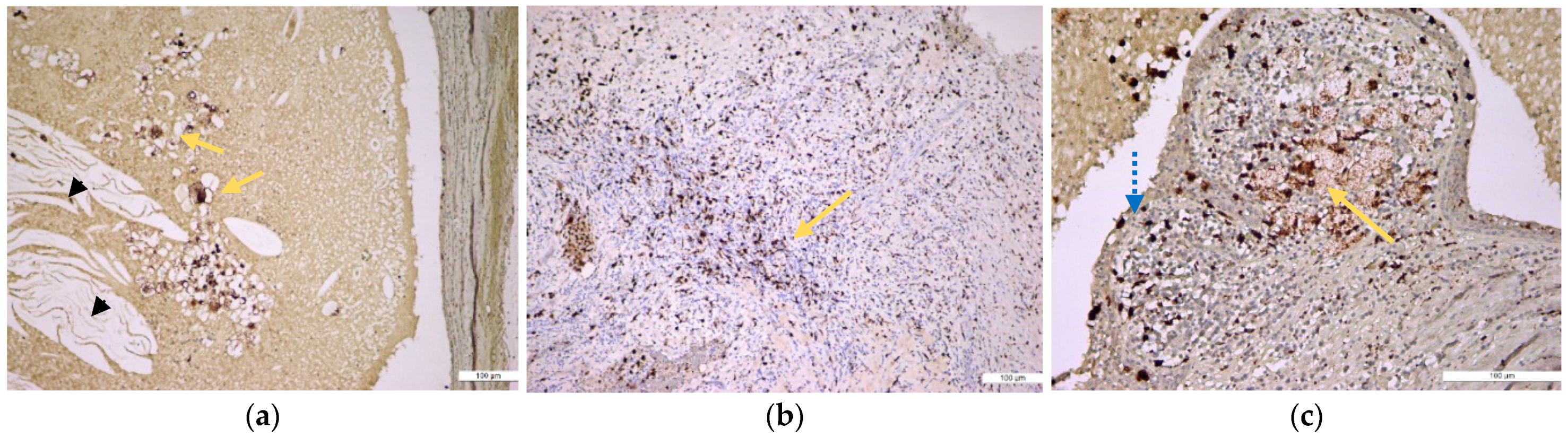 Medicina 57 00840 g006