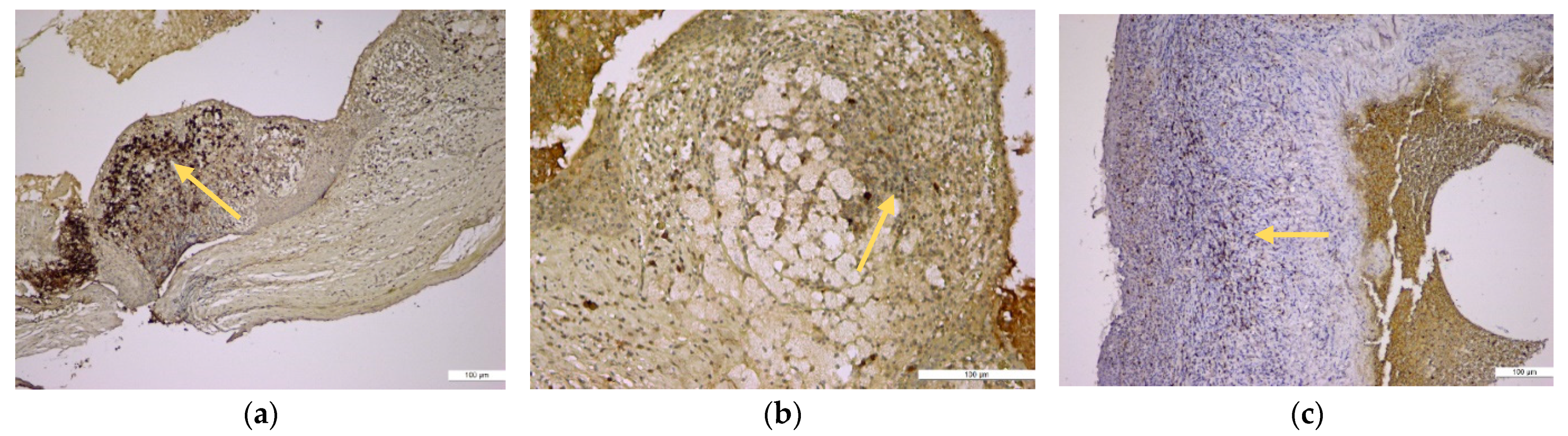 Medicina 57 00840 g007