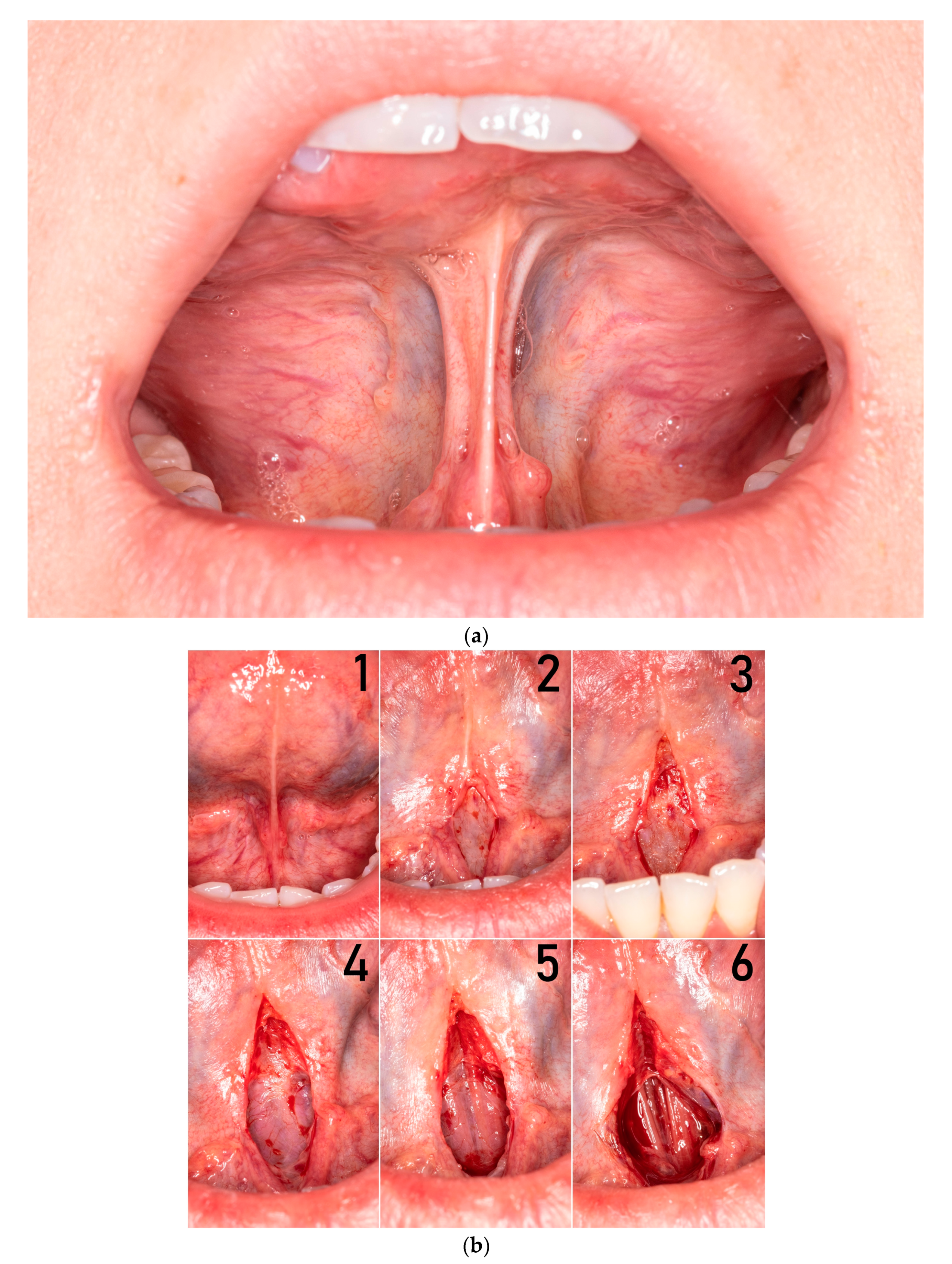 Medicina 57 00848 g001 550