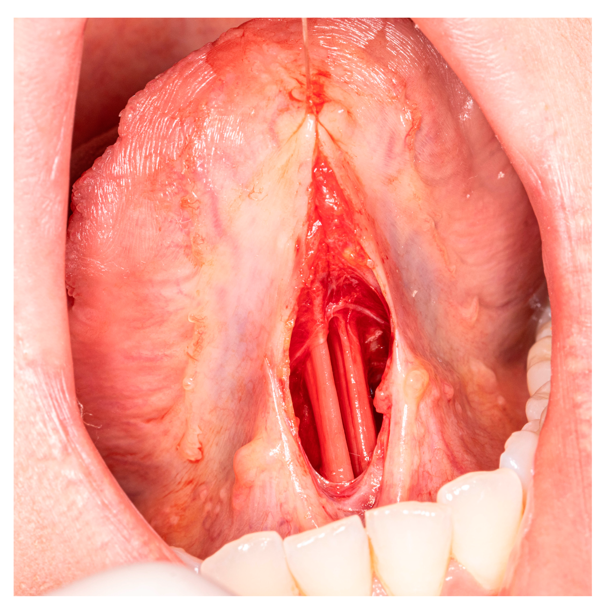 Medicina 57 00848 g002 550