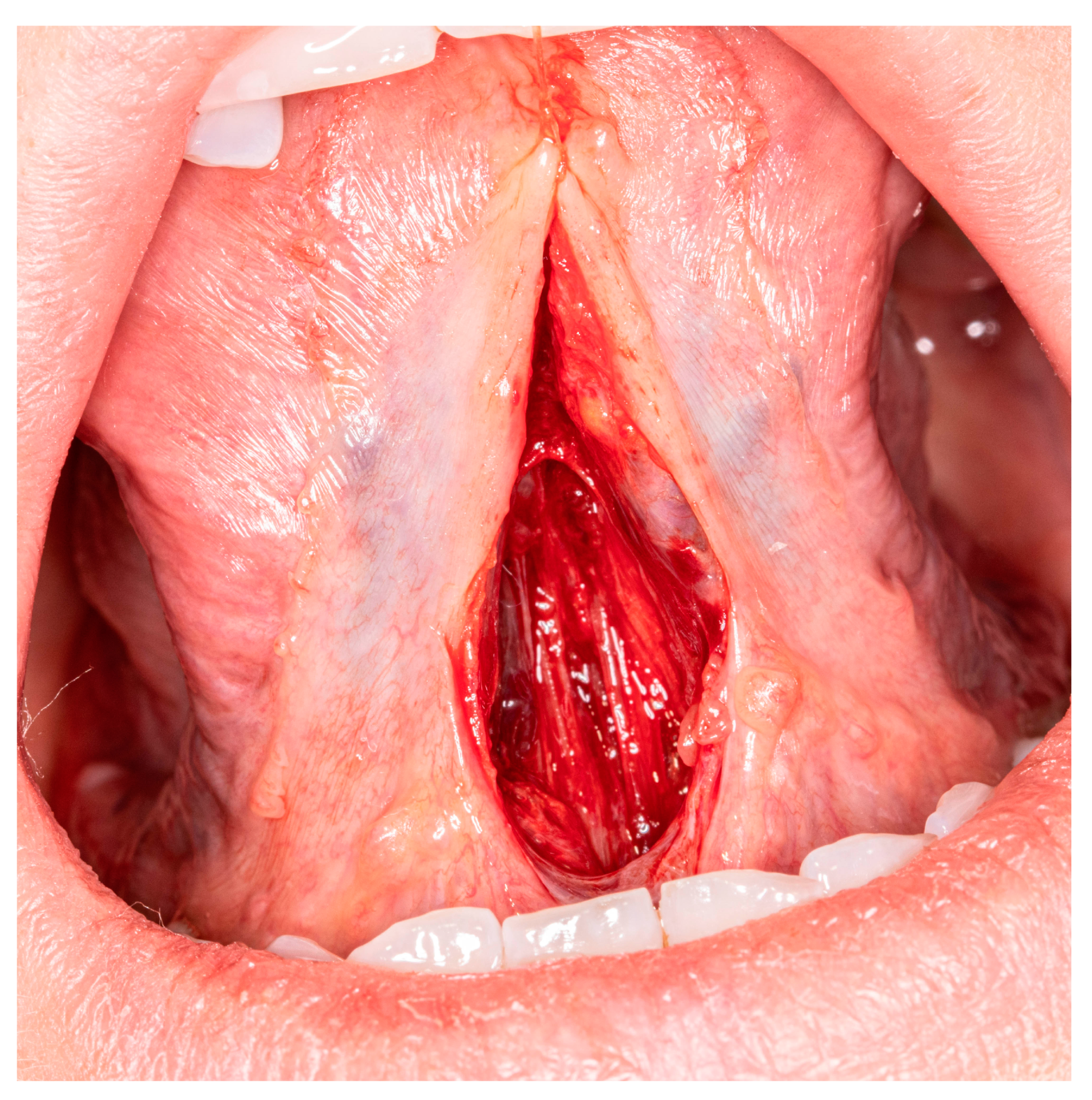 Medicina 57 00848 g003 550