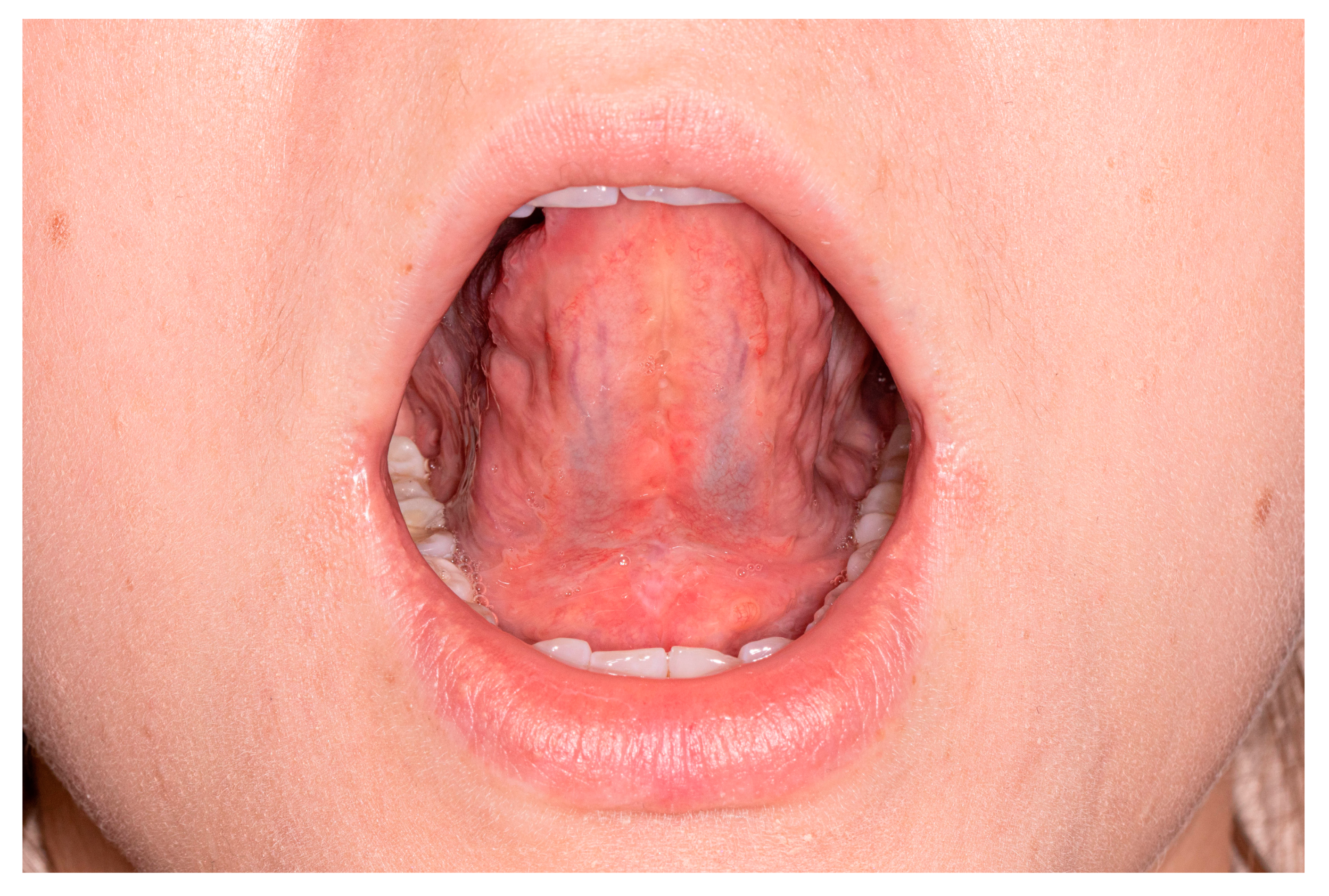 Medicina 57 00848 g005 550