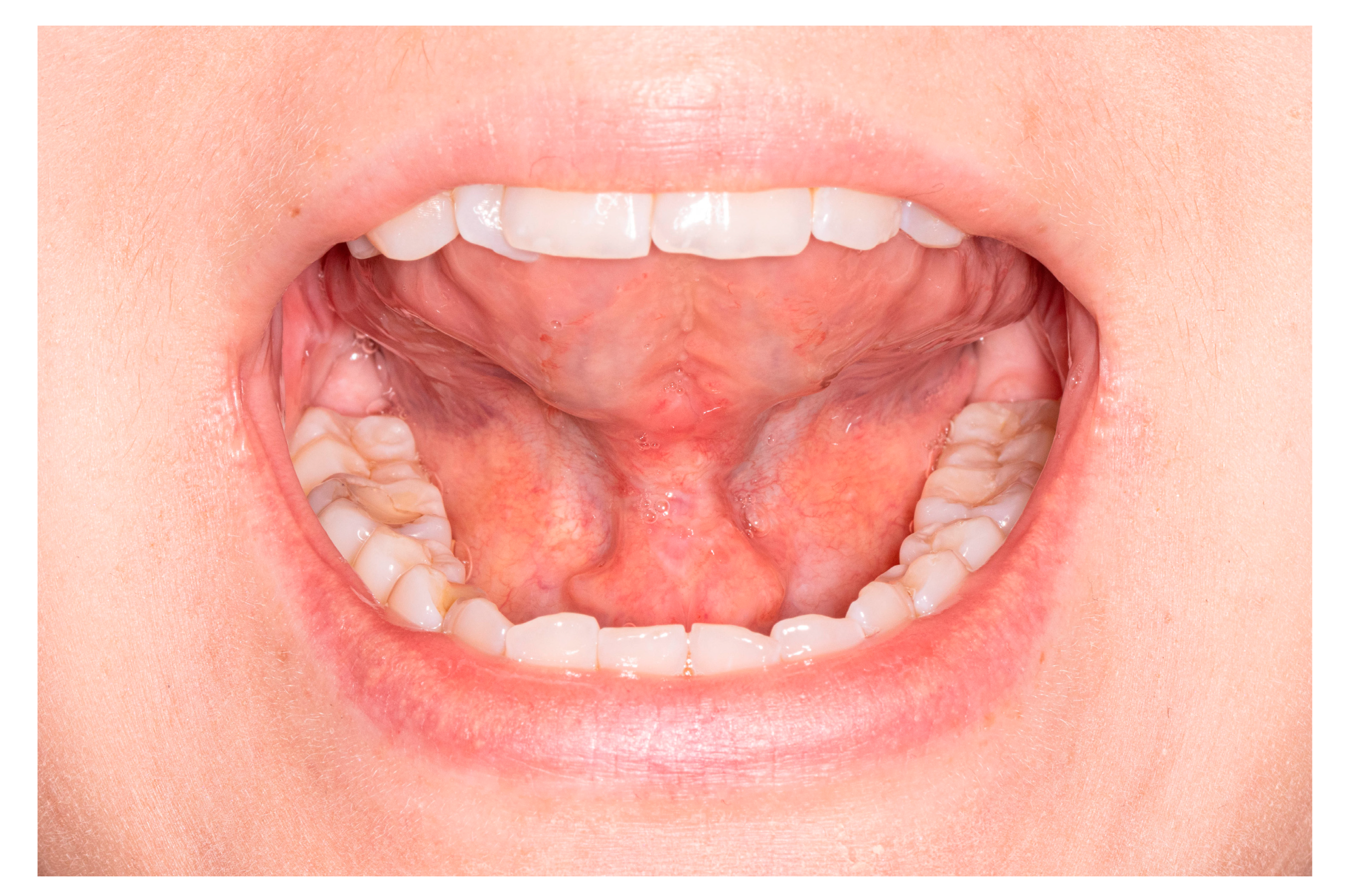 Medicina 57 00848 g006 550